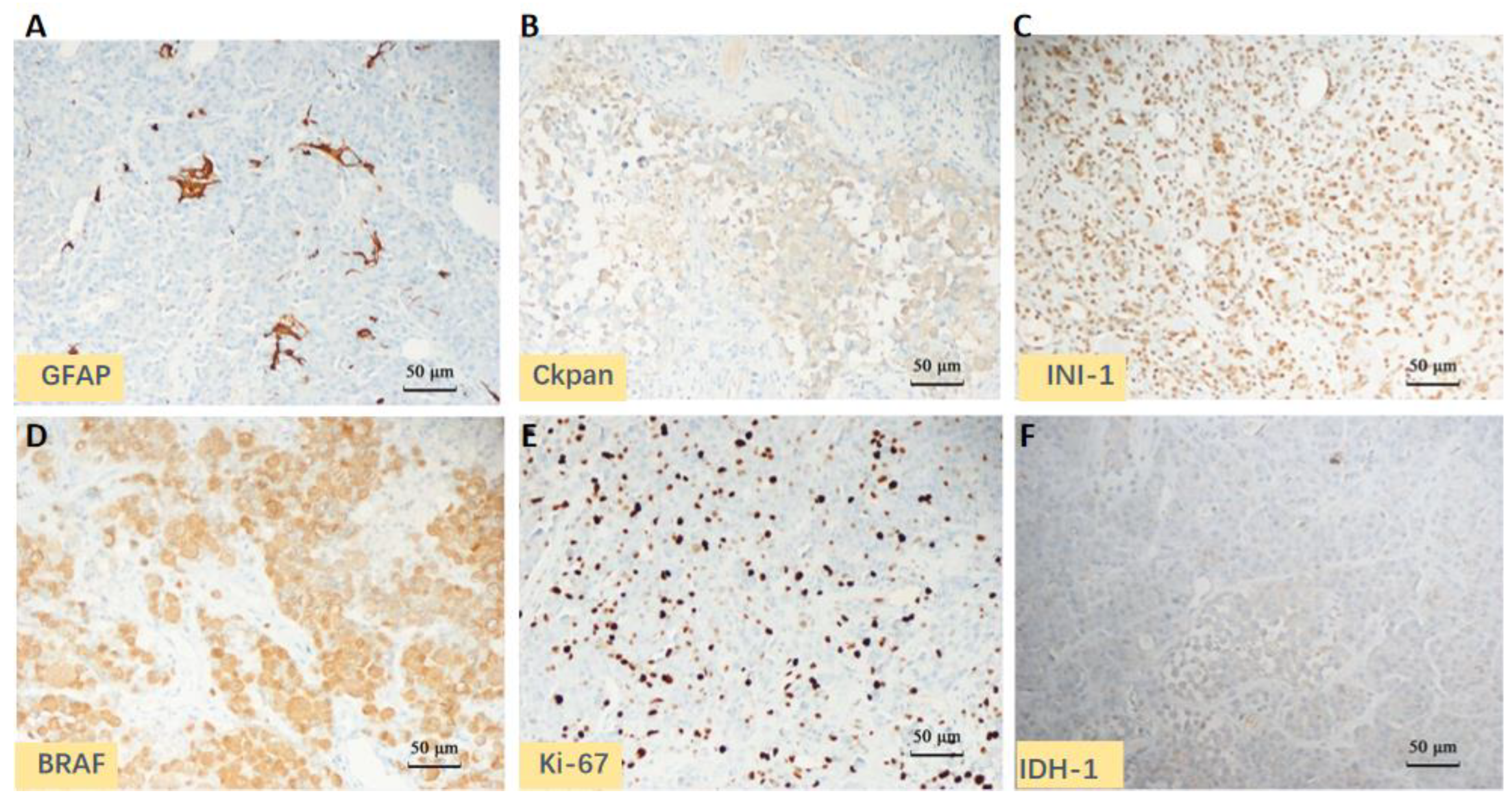 Brainsci 13 00633 g003