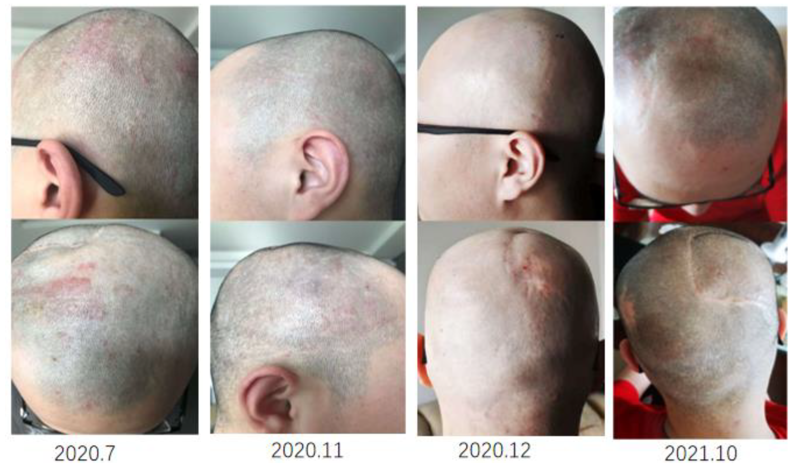 Brainsci 13 00633 g004