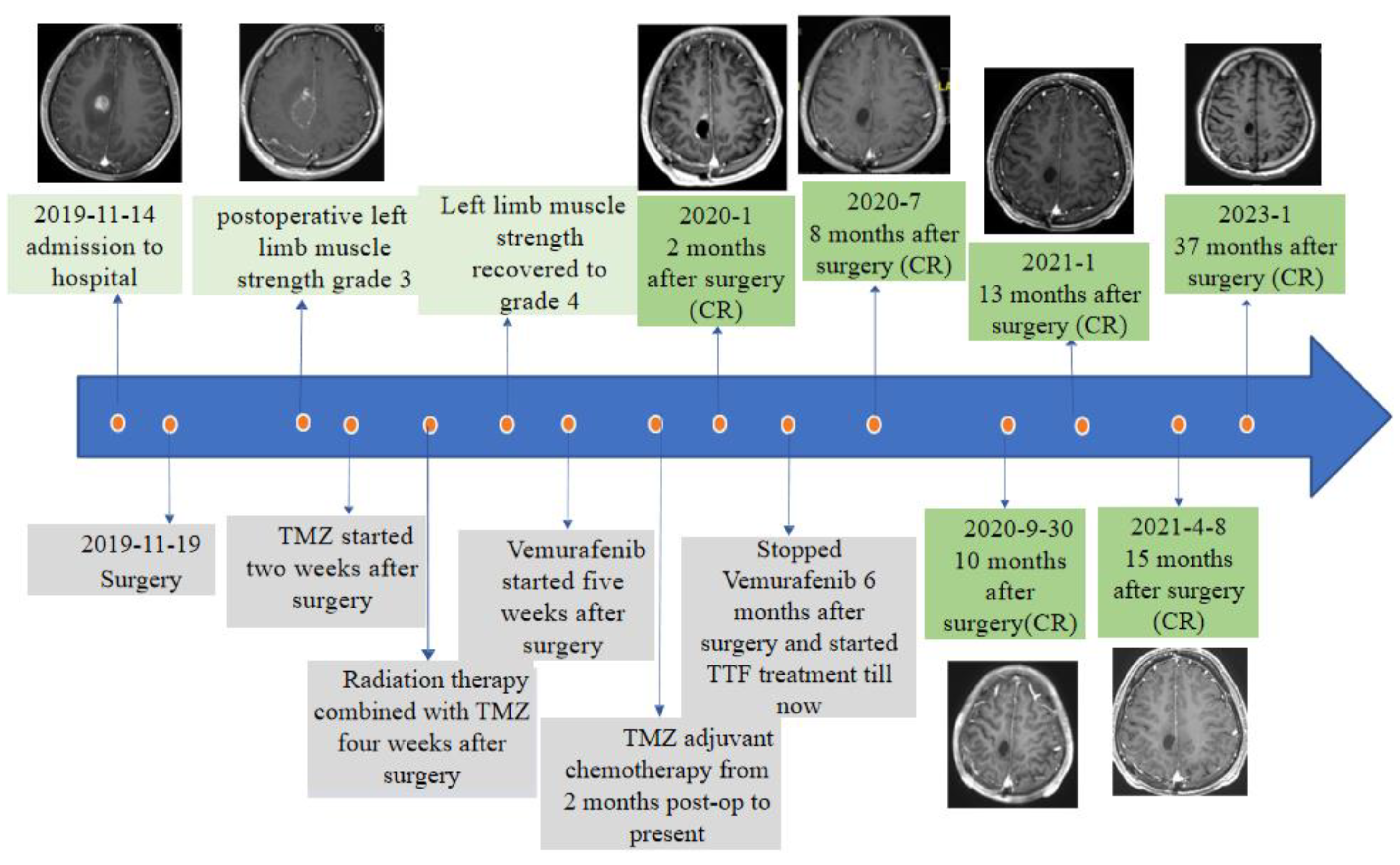Brainsci 13 00633 g005