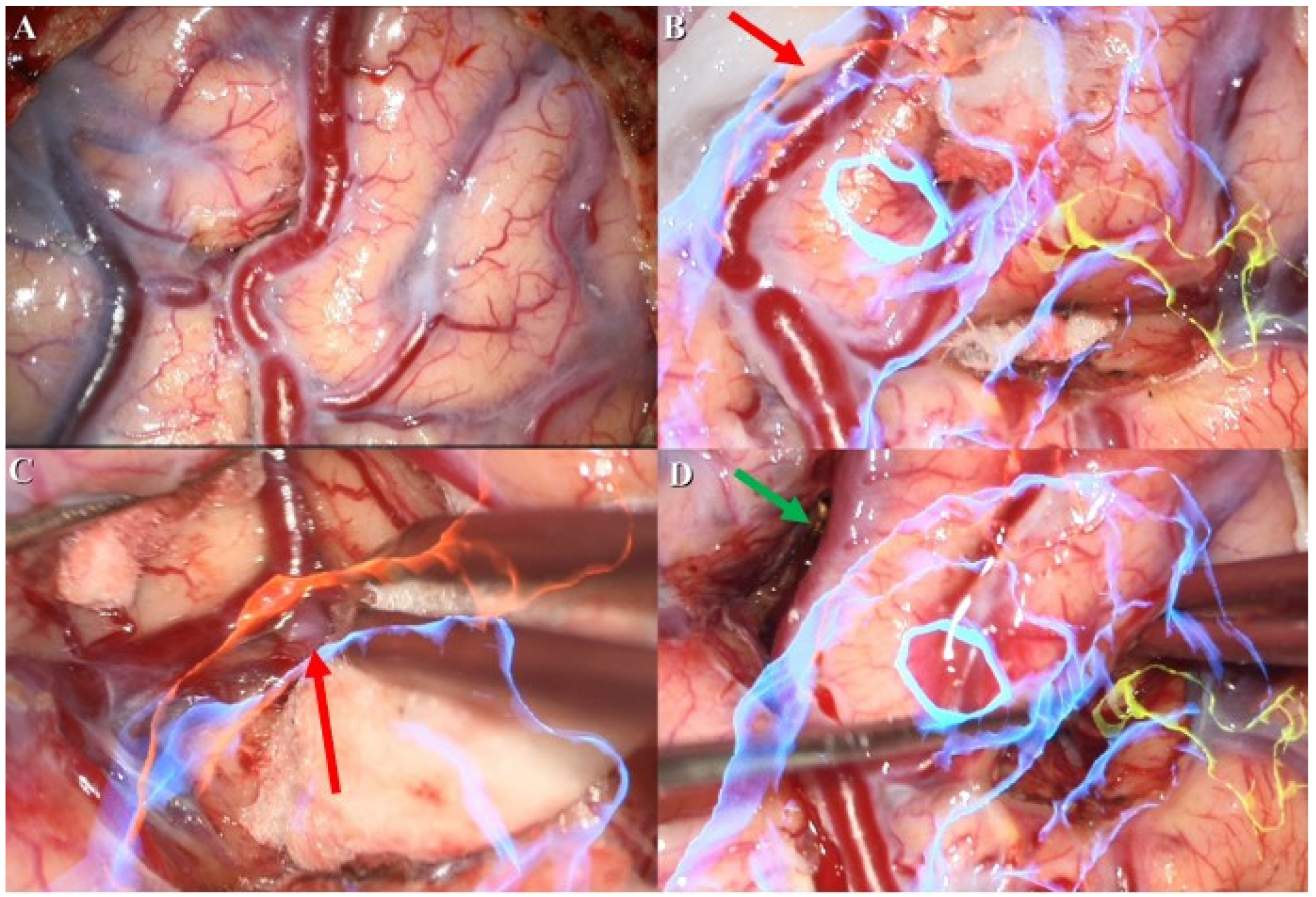 Brainsci 13 00653 g002