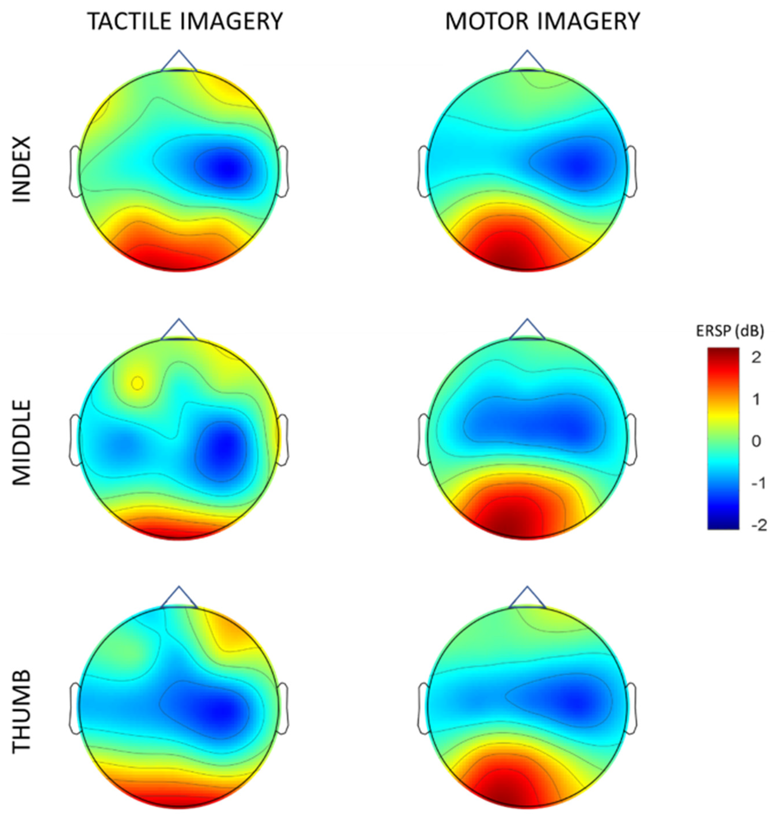 eeg 2011年 Simultaneous stereo-EEG and high-density scalp EEG