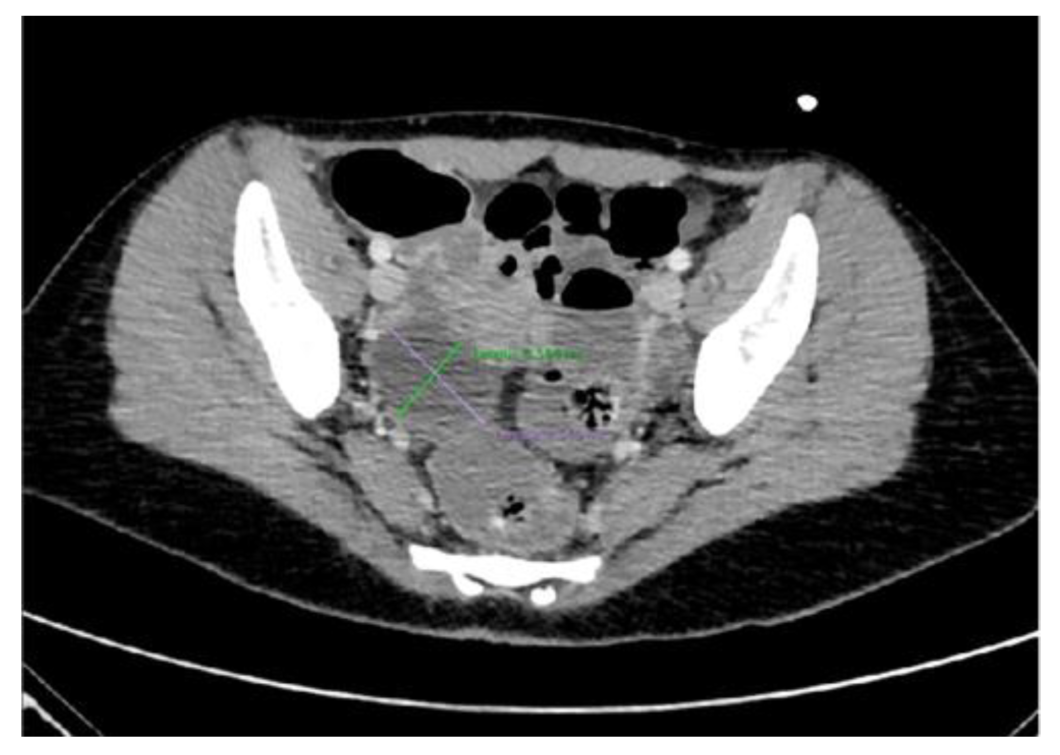 Brainsci 13 00662 g003