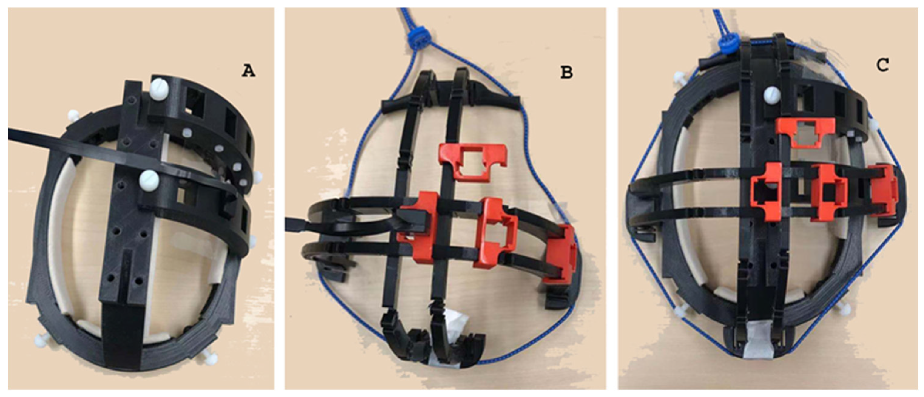 Brainsci 13 00663 g001 Brainsci 13 00663 g001