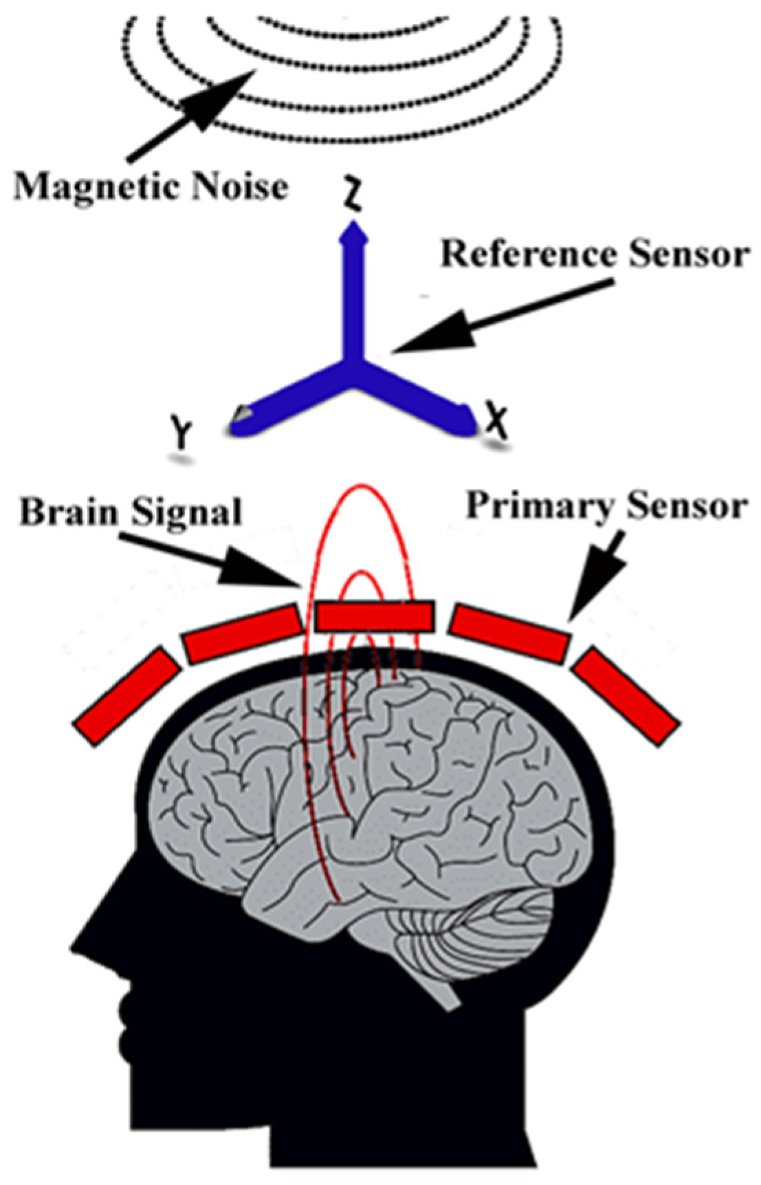 Brainsci 13 00663 g002 Brainsci 13 00663 g002
