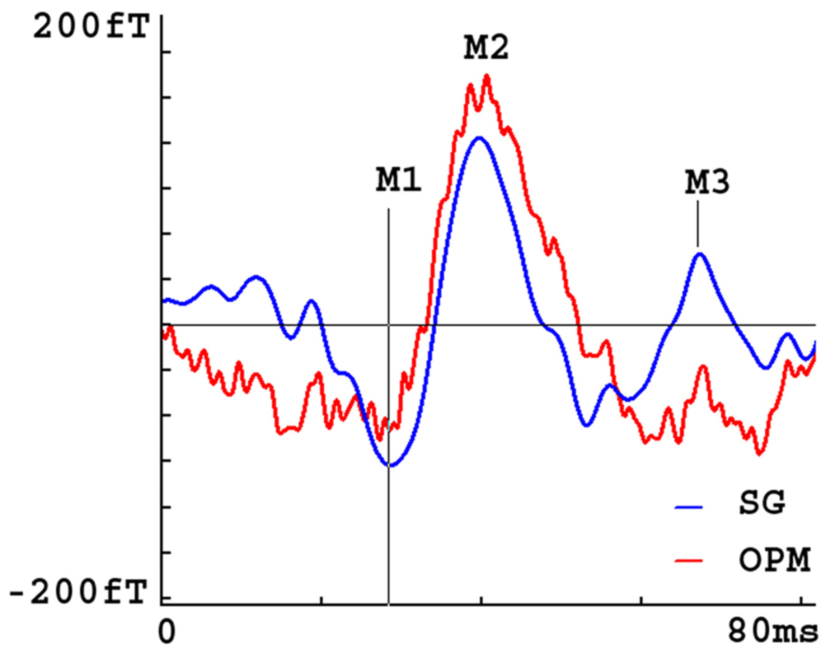 Brainsci 13 00663 g008 Brainsci 13 00663 g008