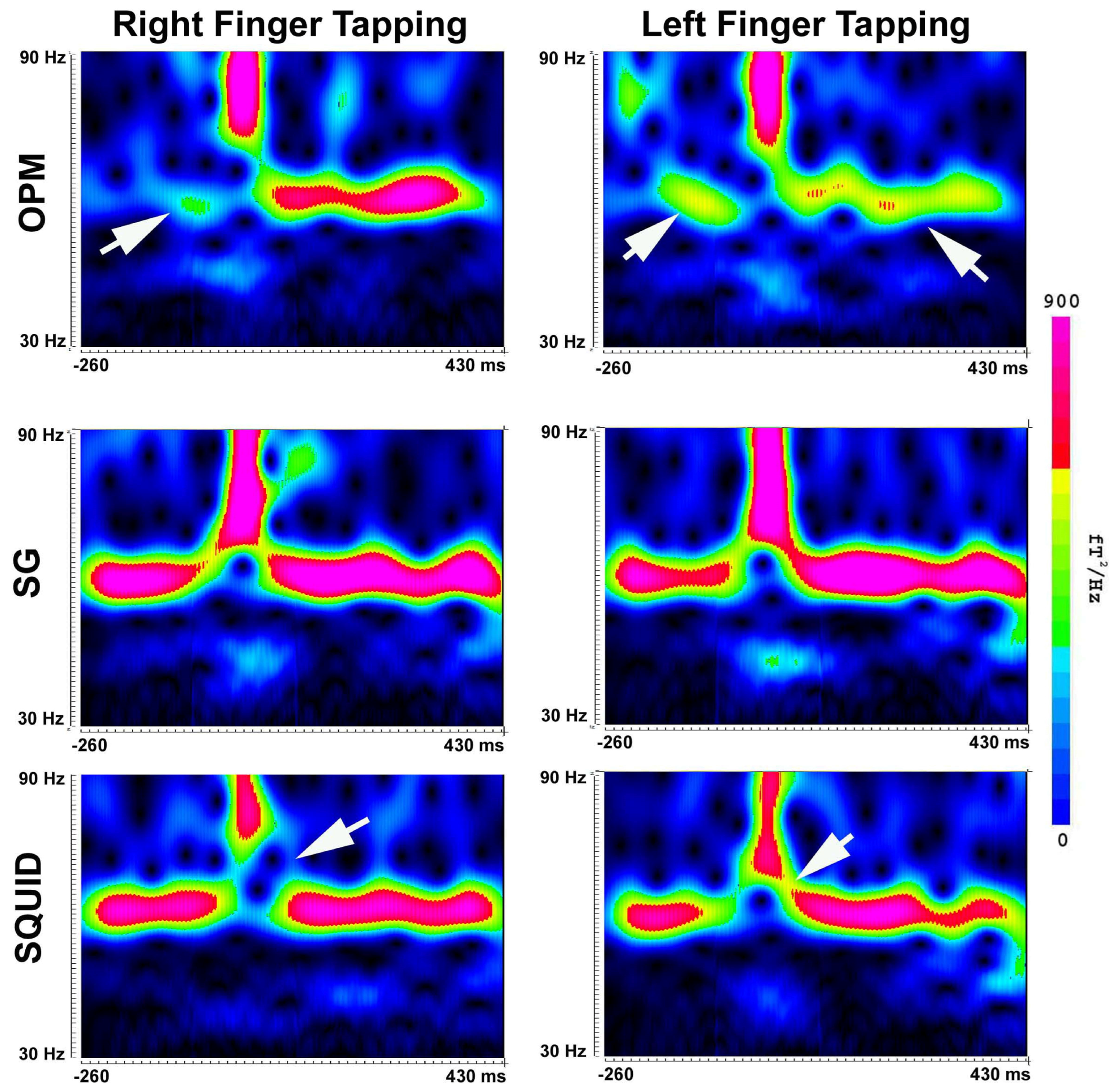 Brainsci 13 00663 g010 Brainsci 13 00663 g010