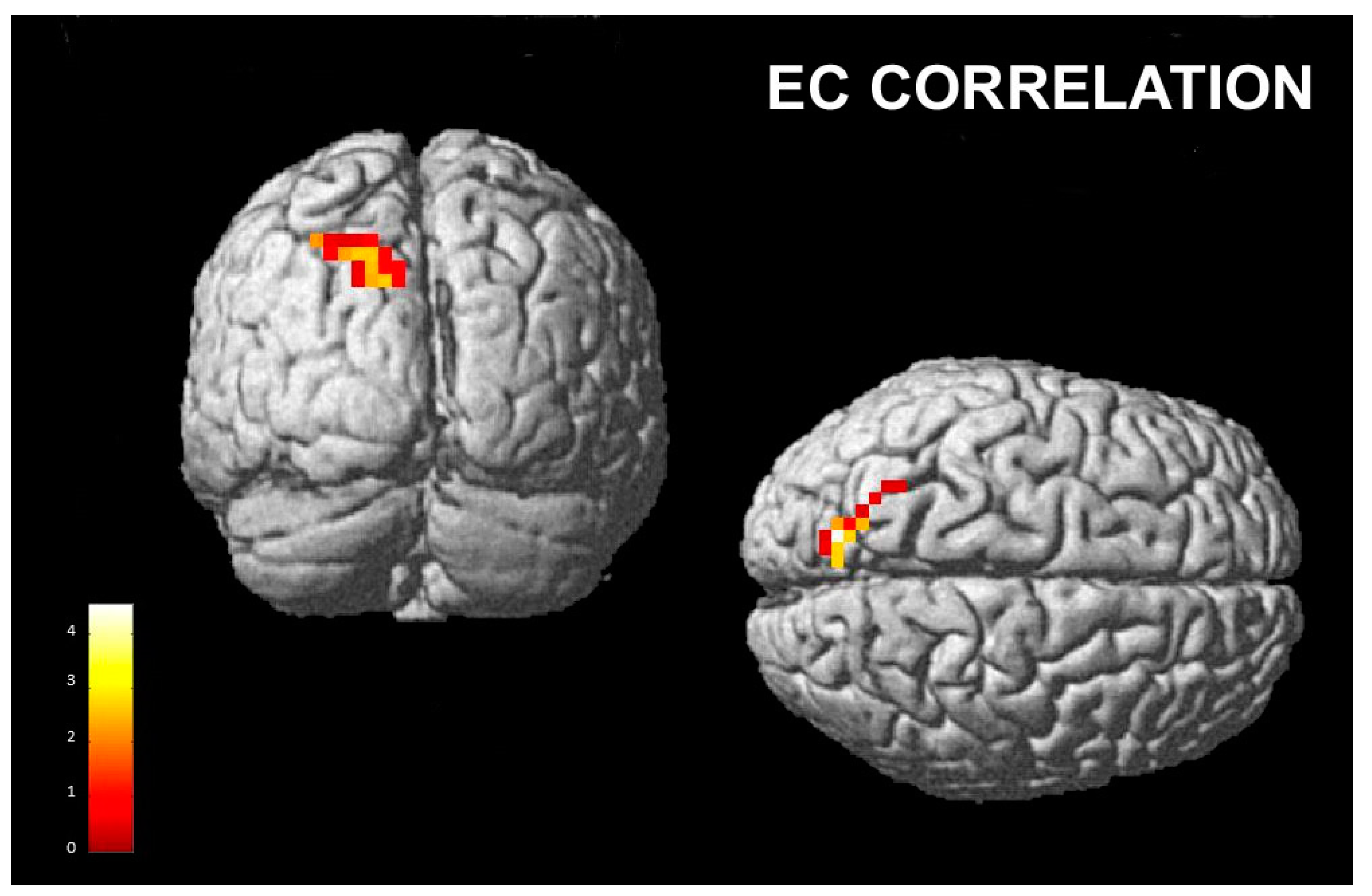 Brainsci 13 00668 g004