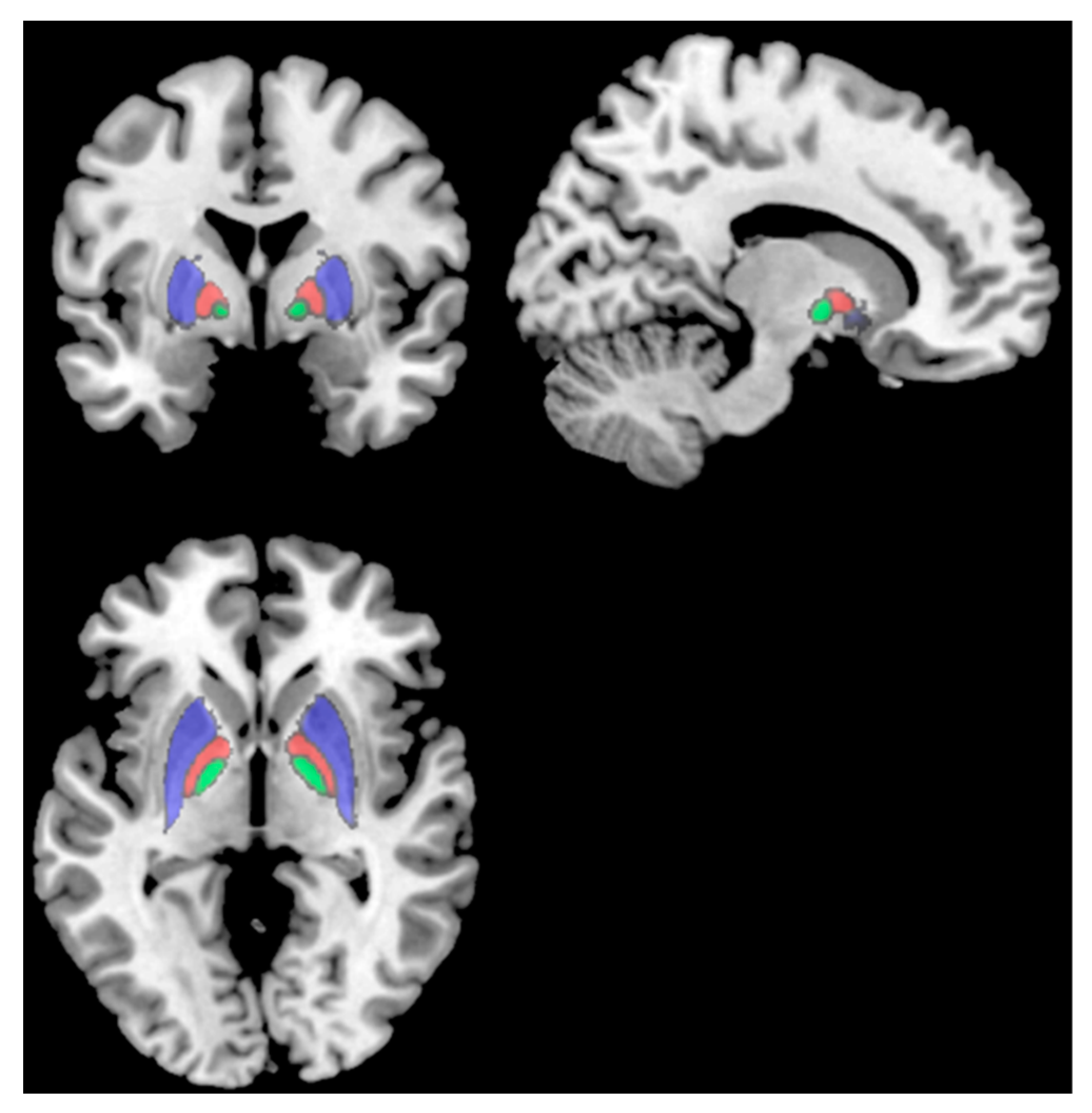 Brainsci 13 00675 g001