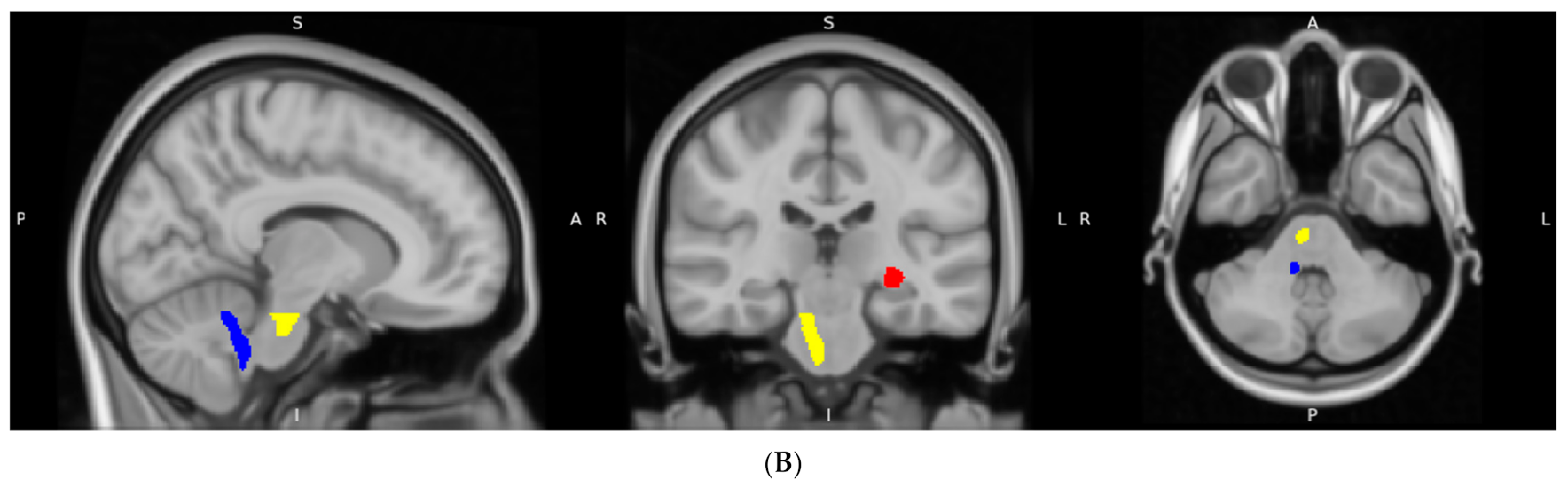 Brainsci 13 00691 g003b Brainsci 13 00691 g003b