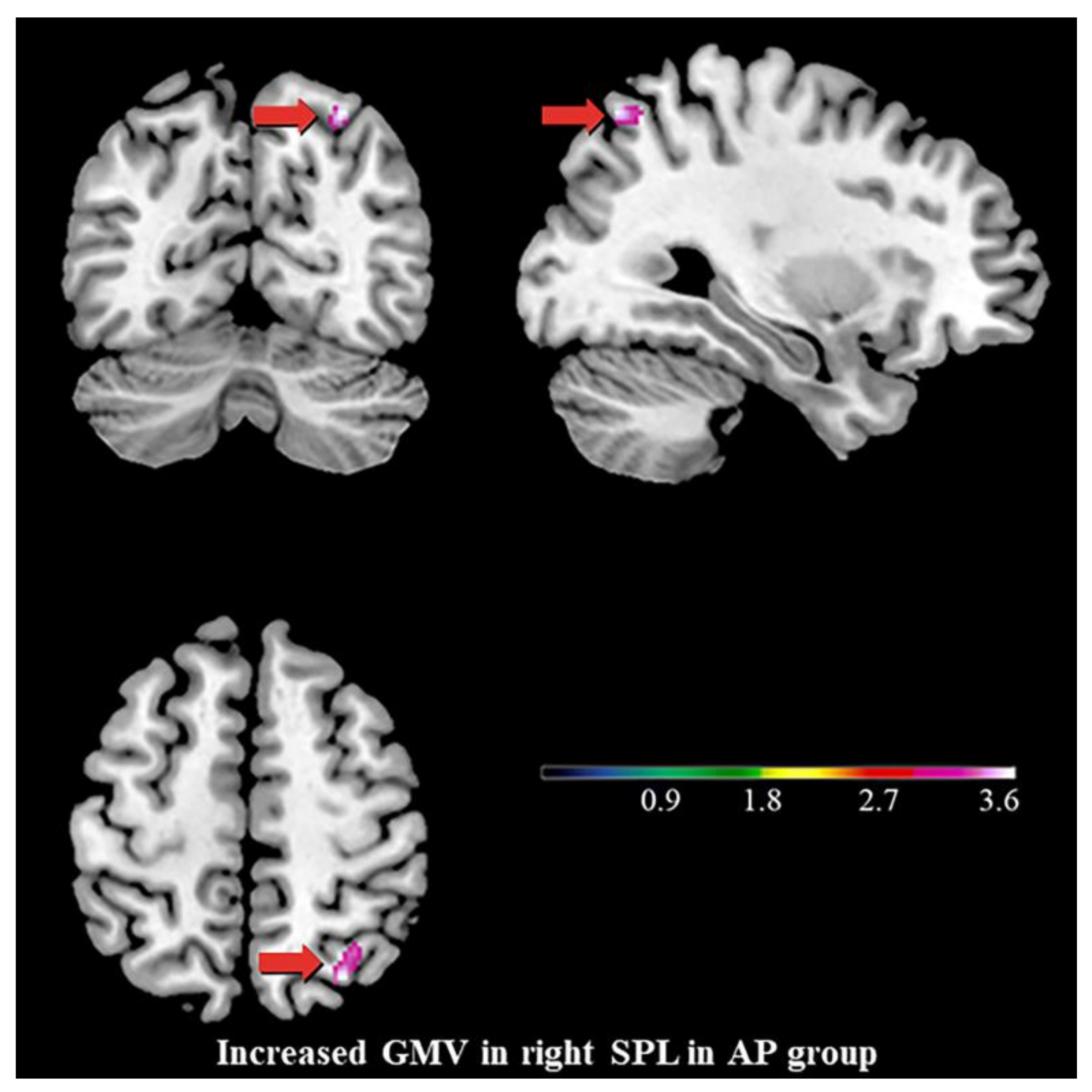 Brainsci 13 00694 g002 Brainsci 13 00694 g002