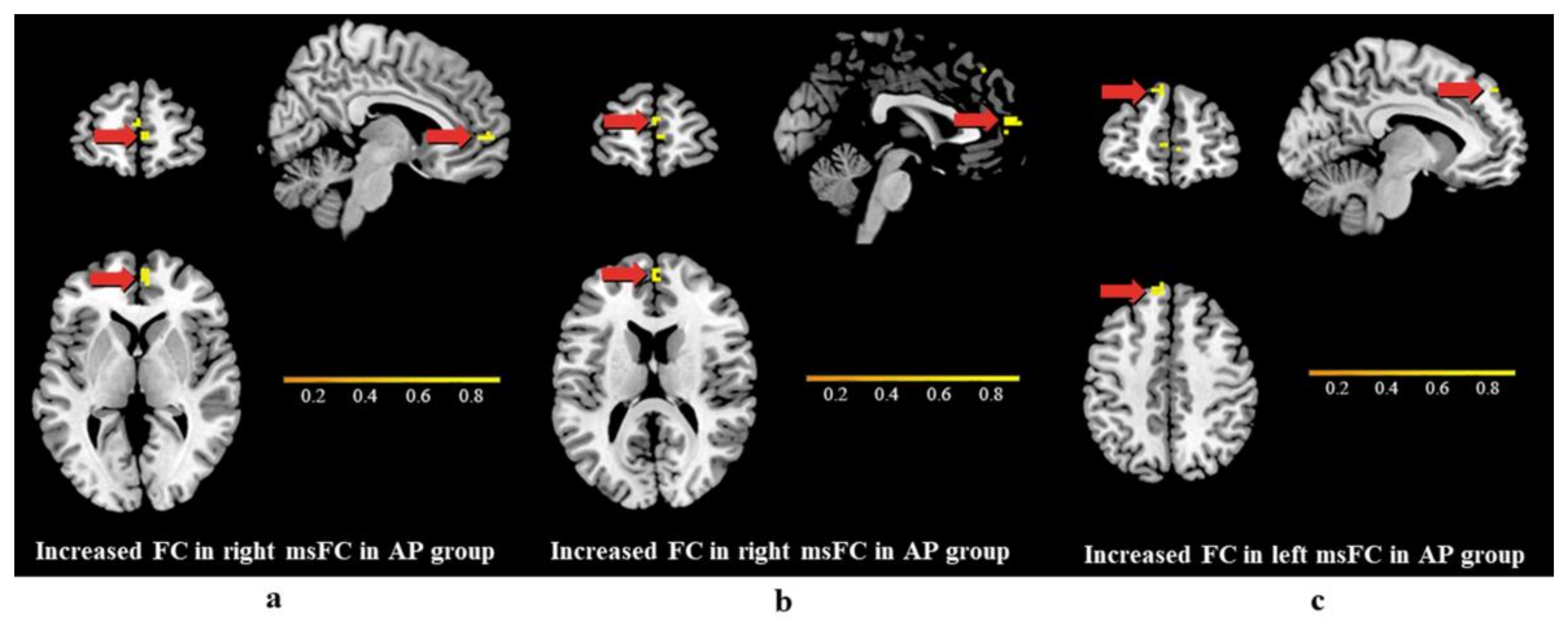 Brainsci 13 00694 g003 Brainsci 13 00694 g003