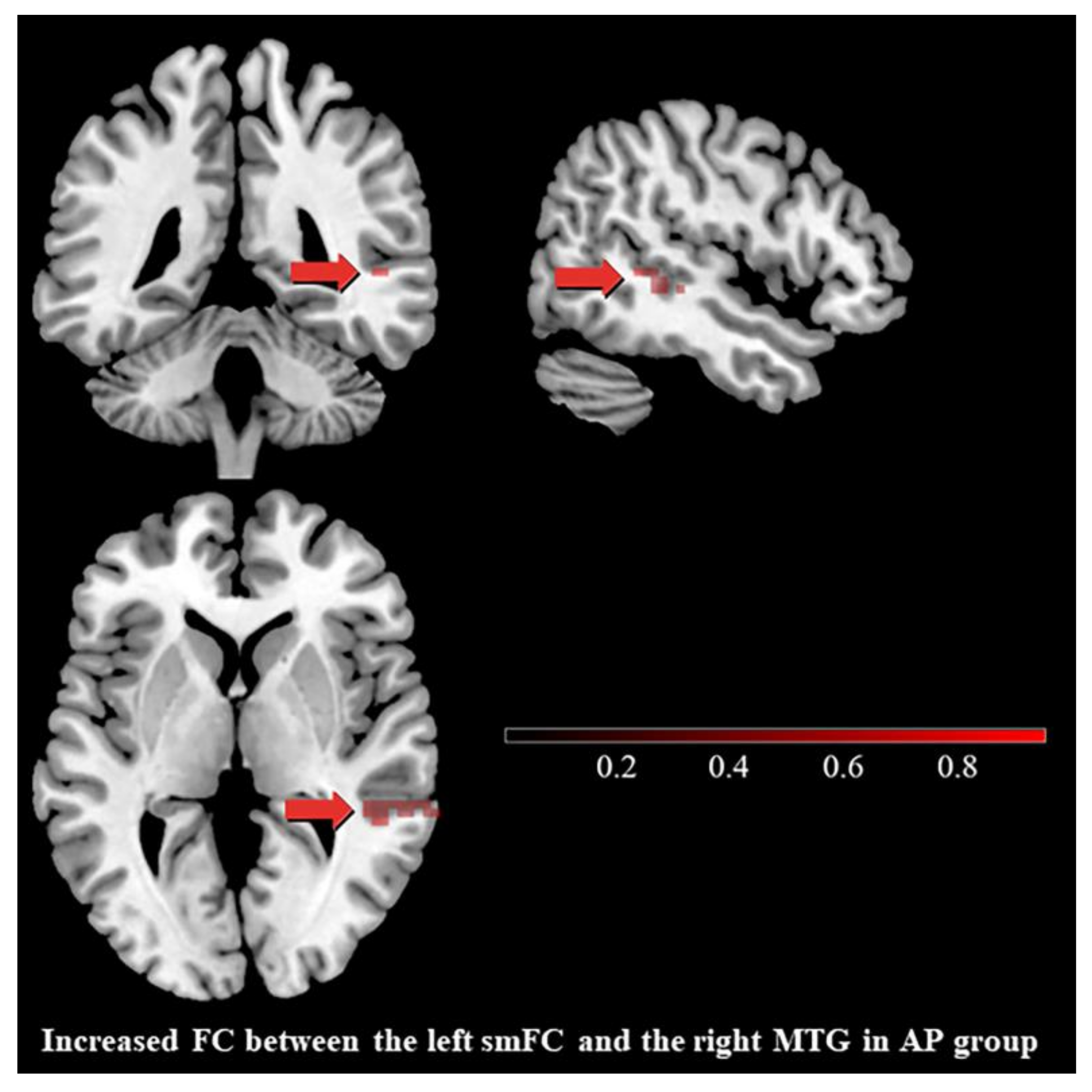 Brainsci 13 00694 g004 Brainsci 13 00694 g004