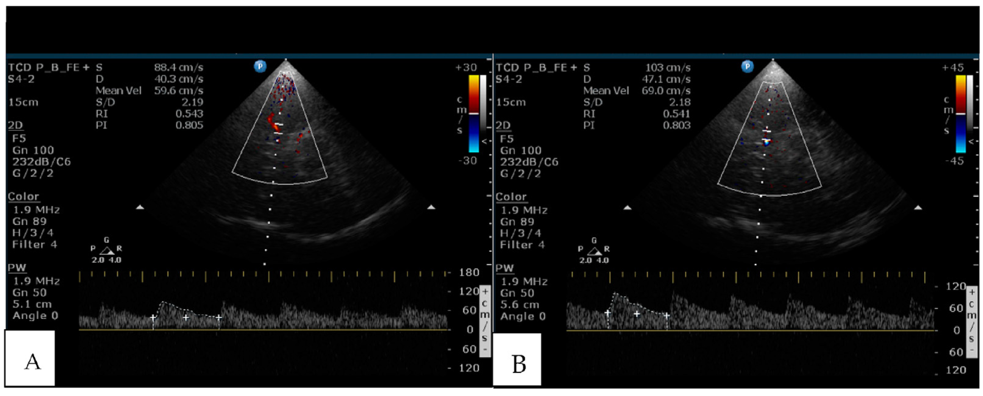 Brainsci 13 00709 g001 Brainsci 13 00709 g001