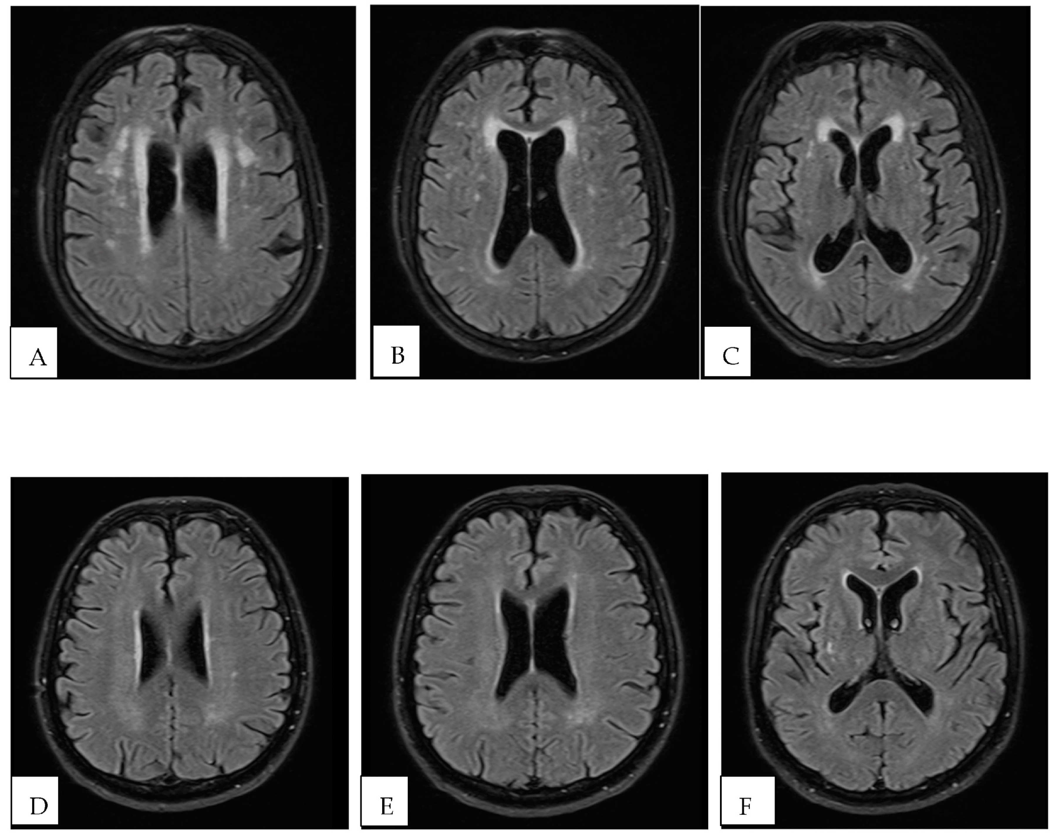 Brainsci 13 00709 g002 Brainsci 13 00709 g002