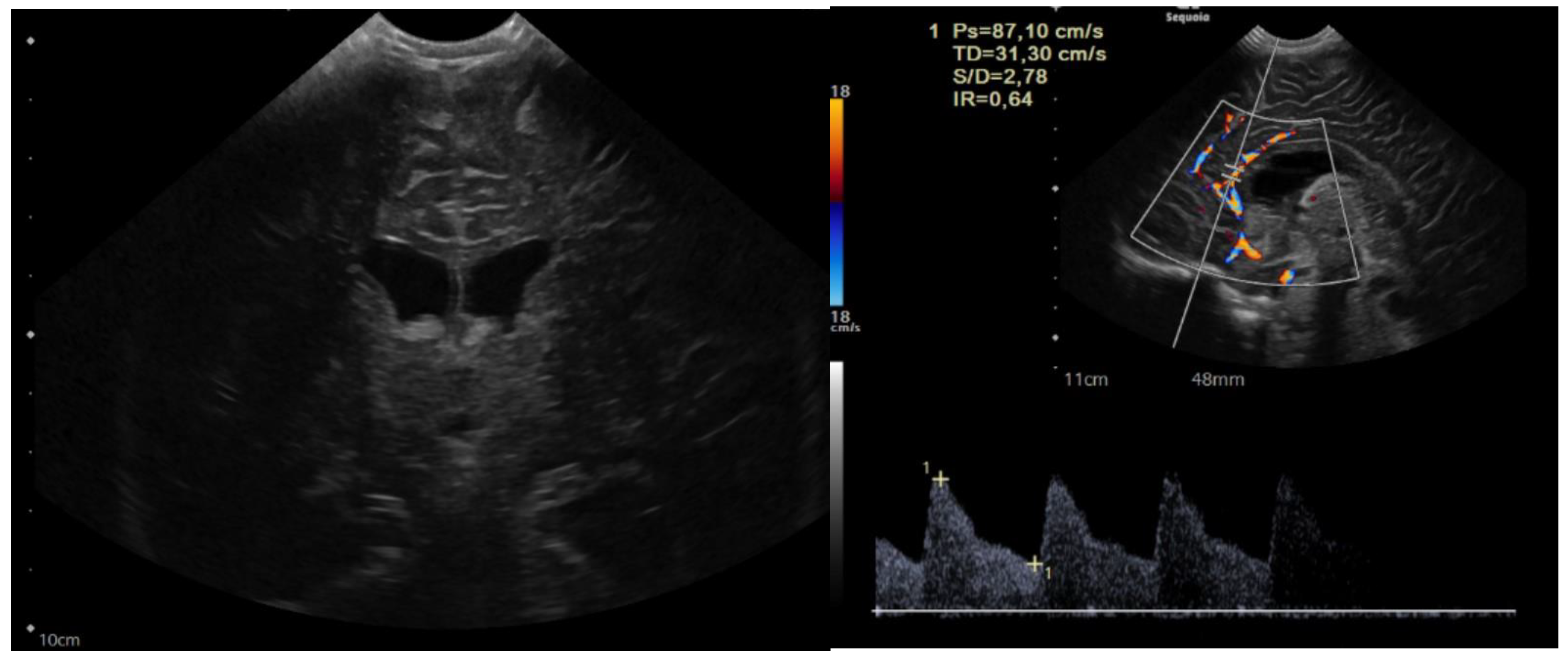 Brainsci 13 00712 g001