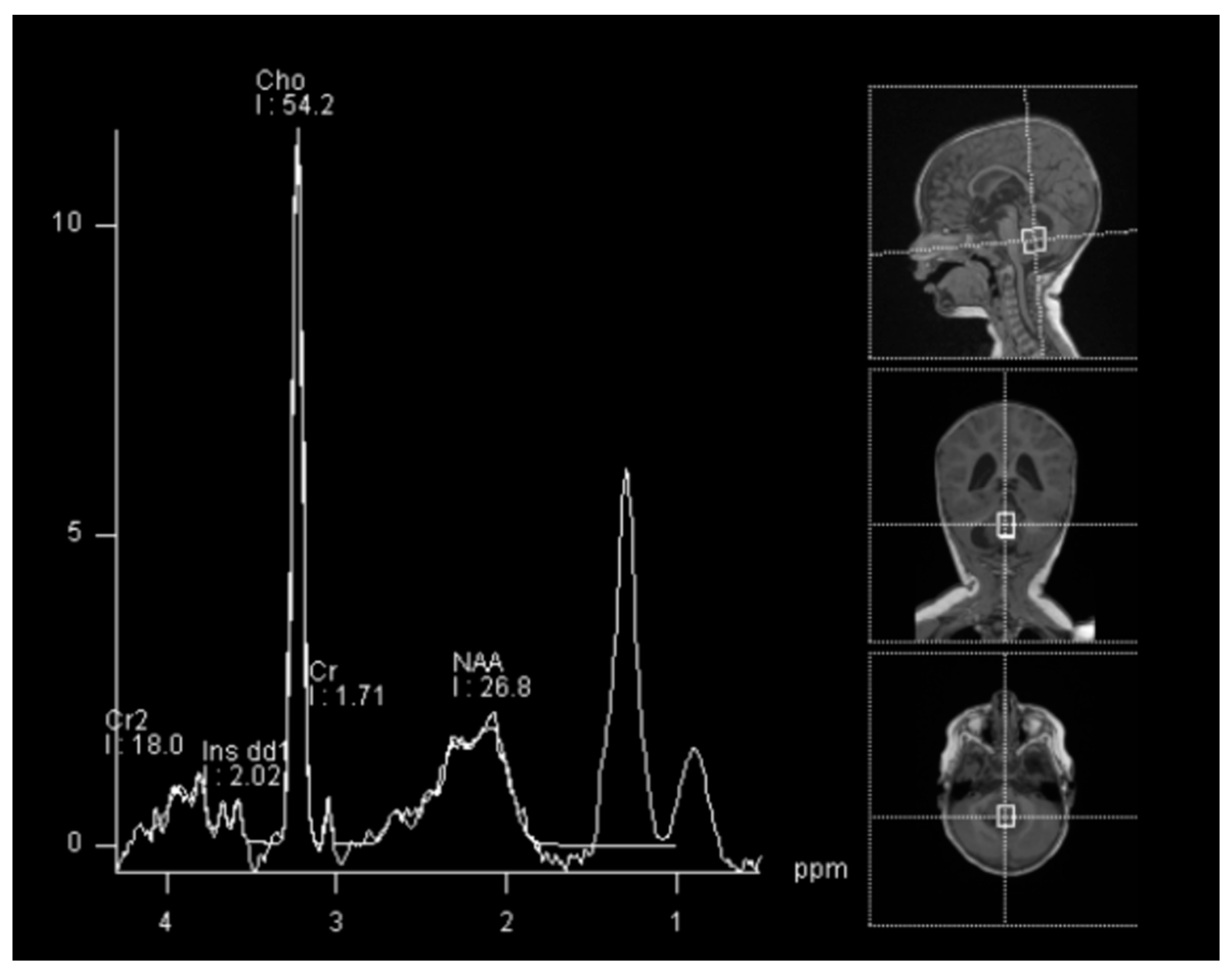 Brainsci 13 00712 g003