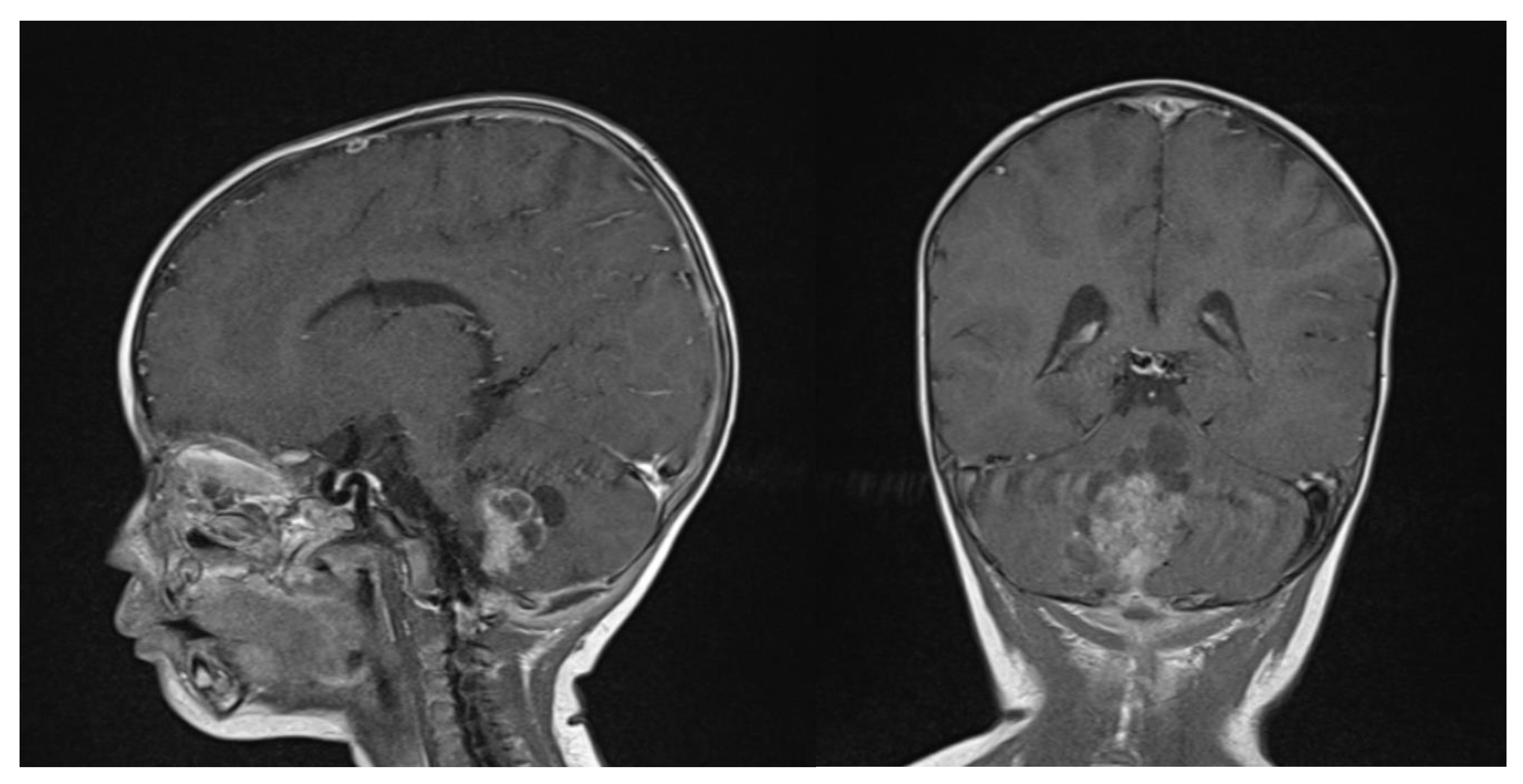 Brainsci 13 00712 g005