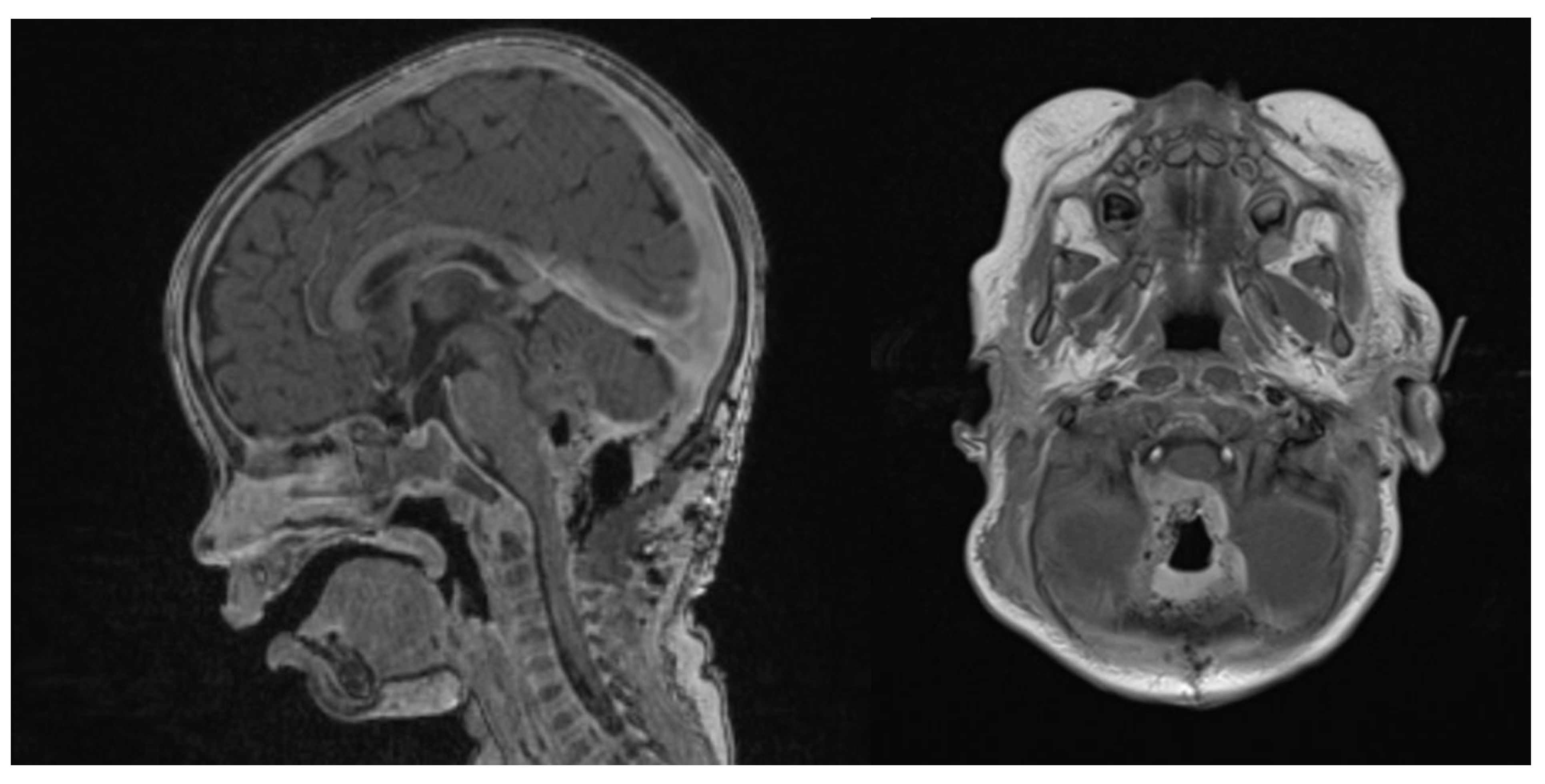 Brainsci 13 00712 g006