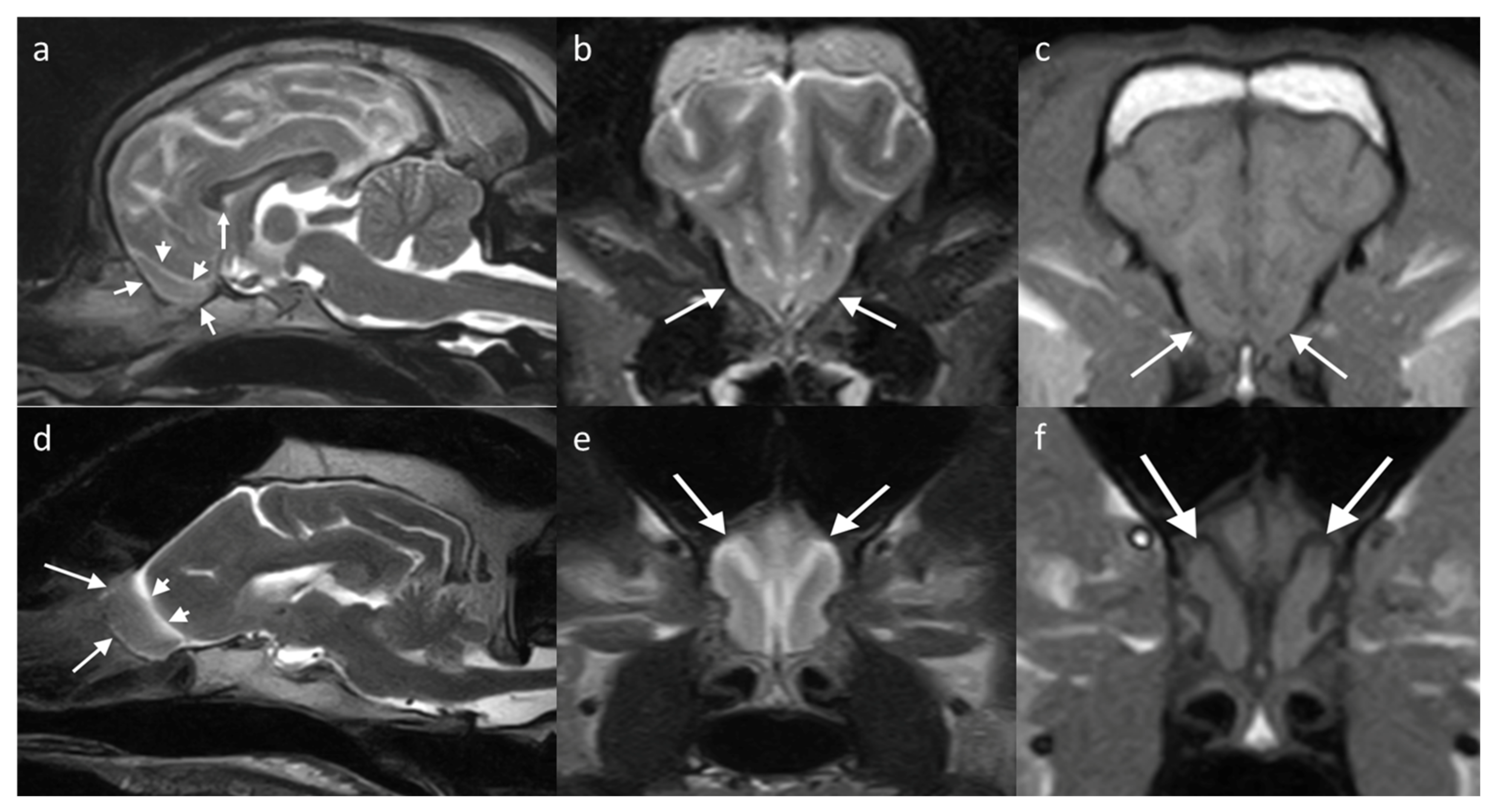 Brainsci 13 00713 g005