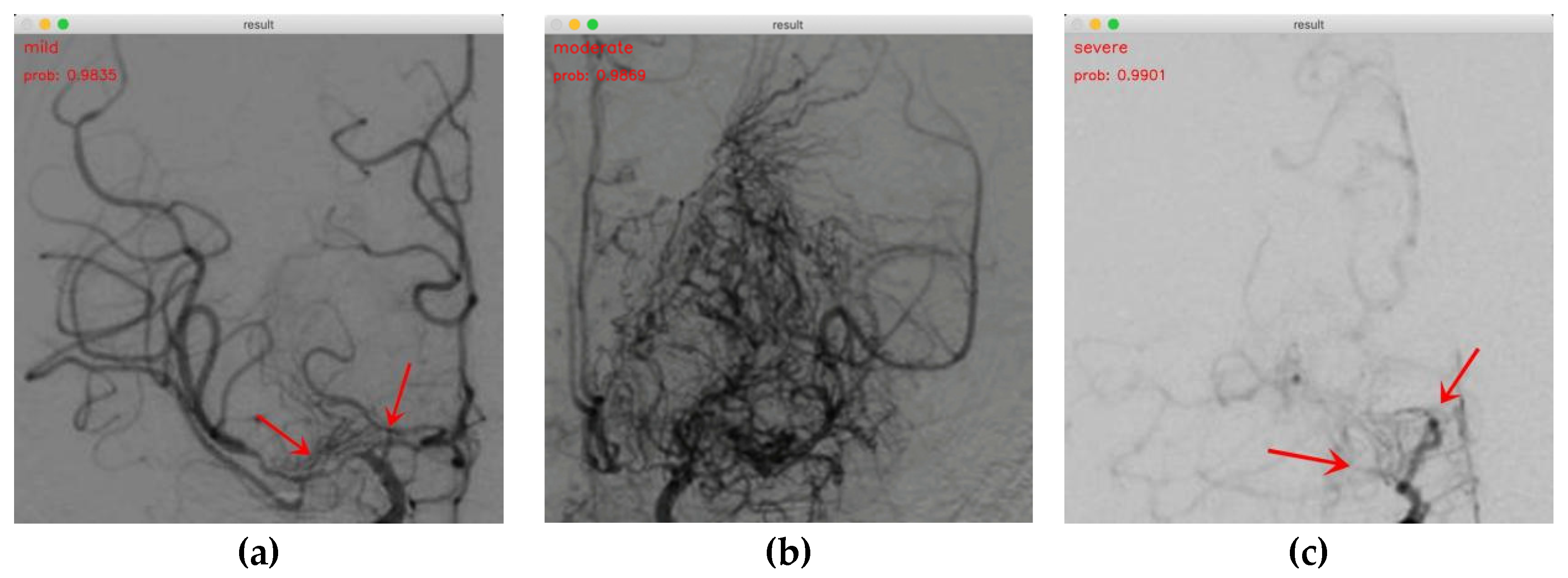 Brainsci 13 00742 g008 Brainsci 13 00742 g008