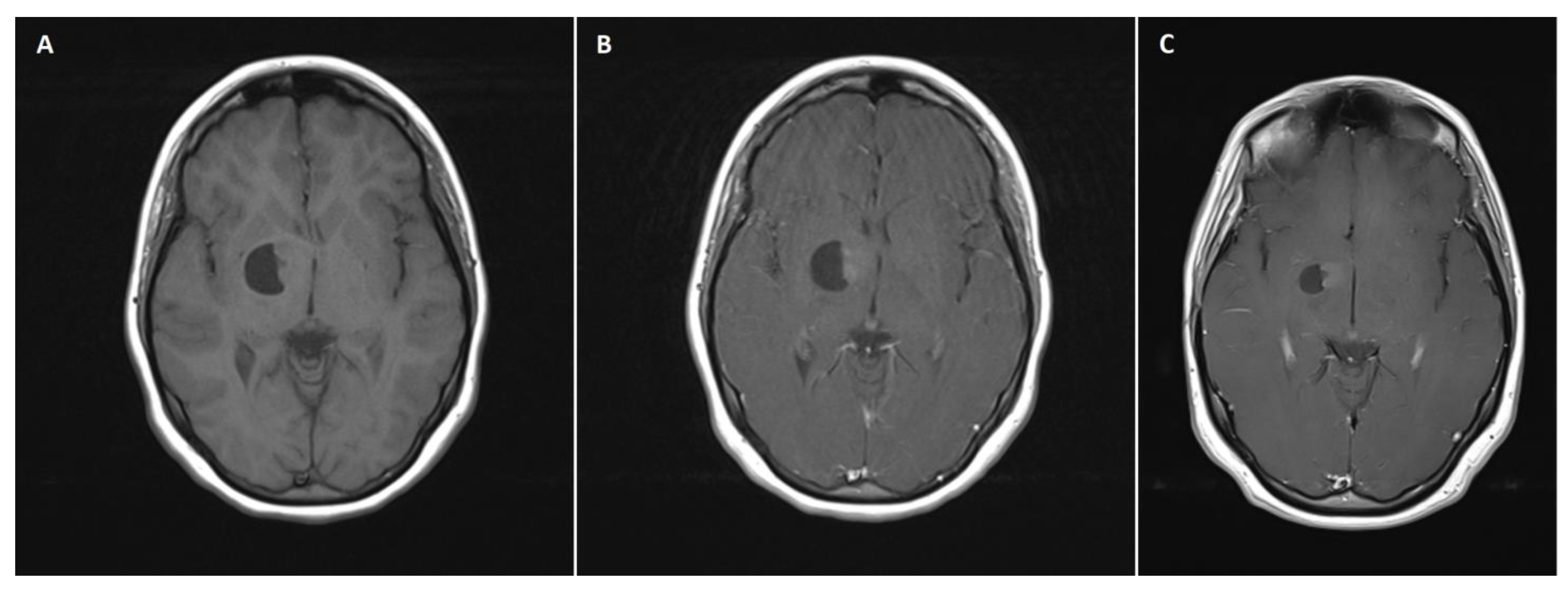 Brainsci 13 00746 g001