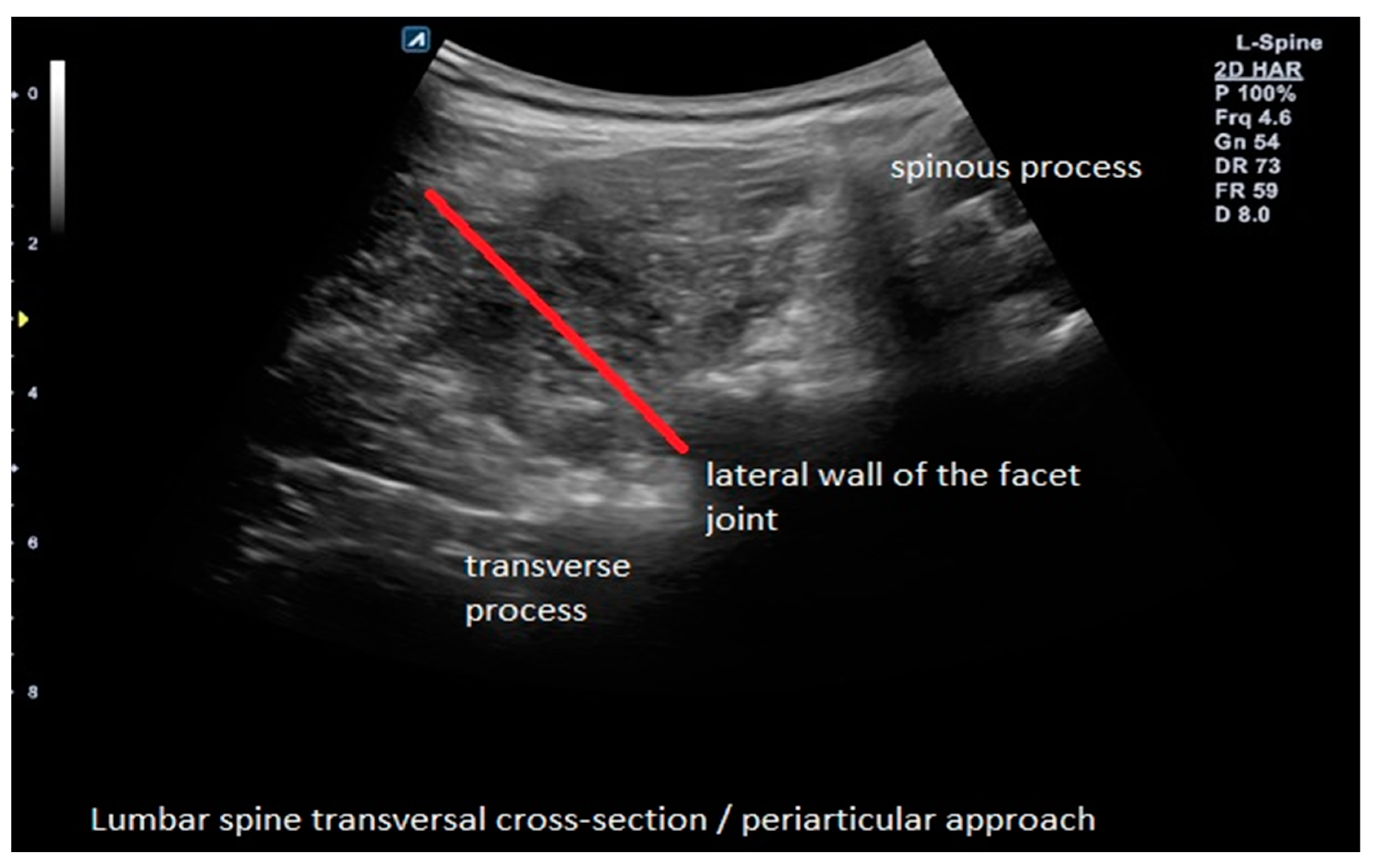 Brainsci 13 00749 g001 Brainsci 13 00749 g001