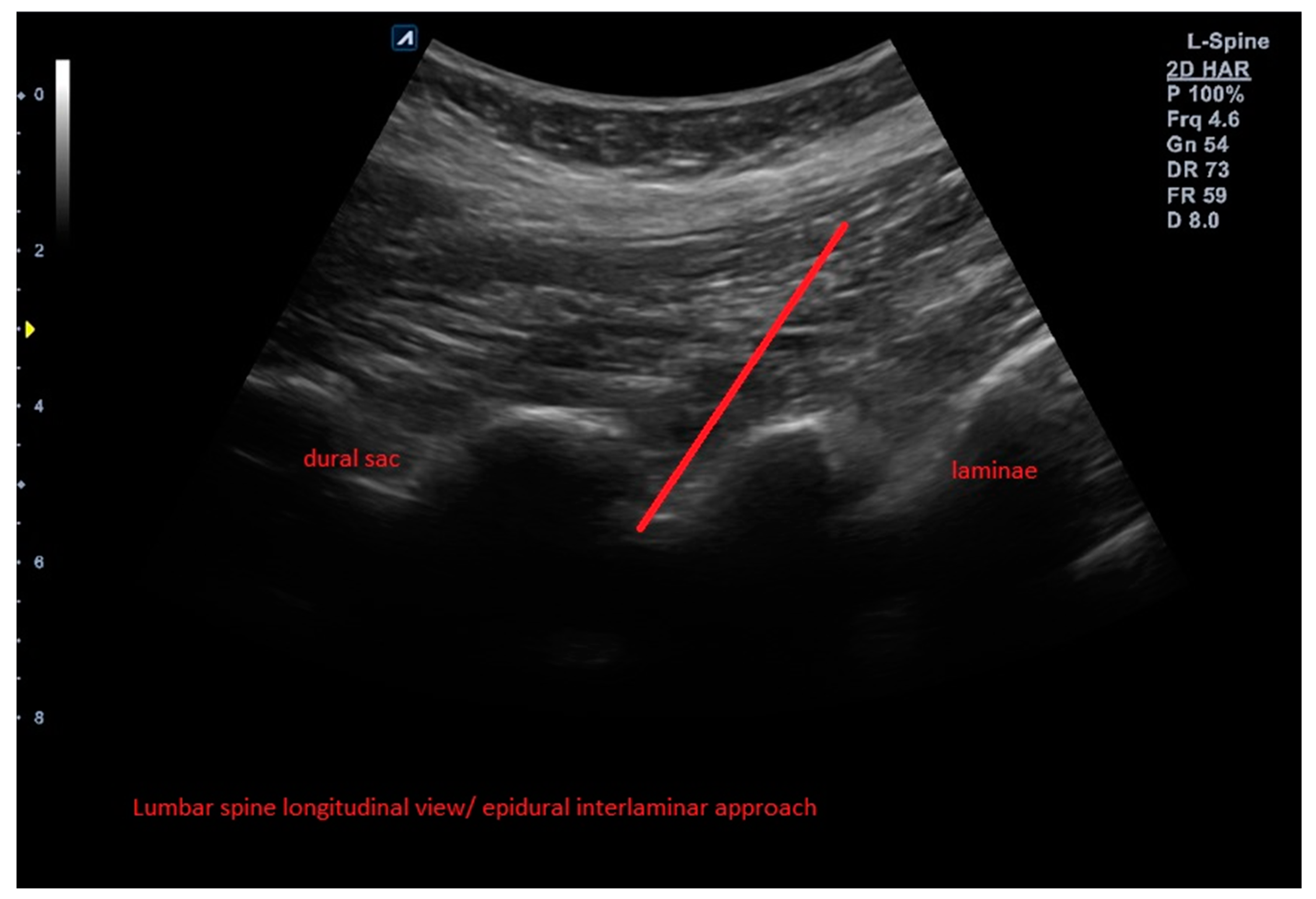 Brainsci 13 00749 g002 Brainsci 13 00749 g002