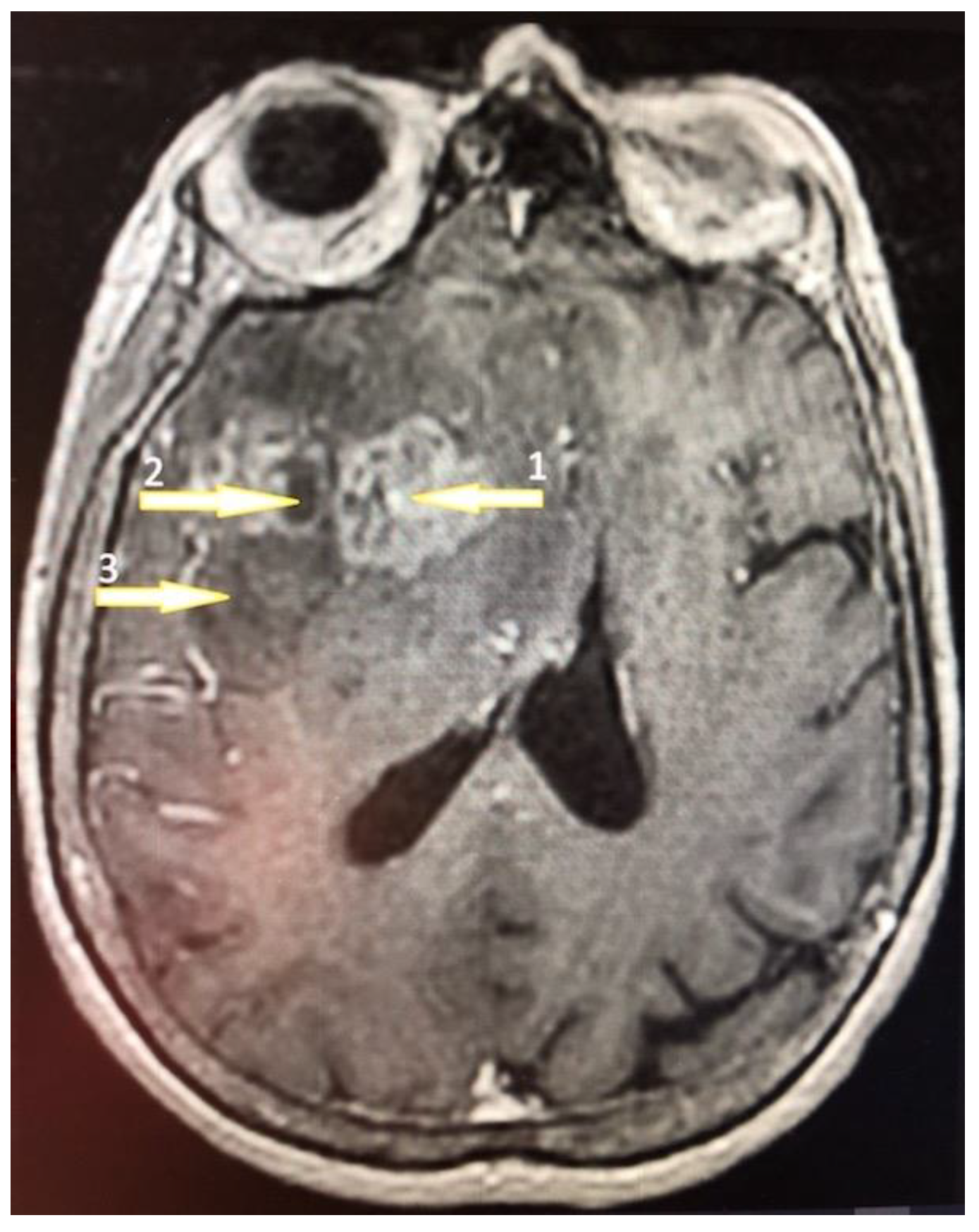 Brainsci 13 00771 g001
