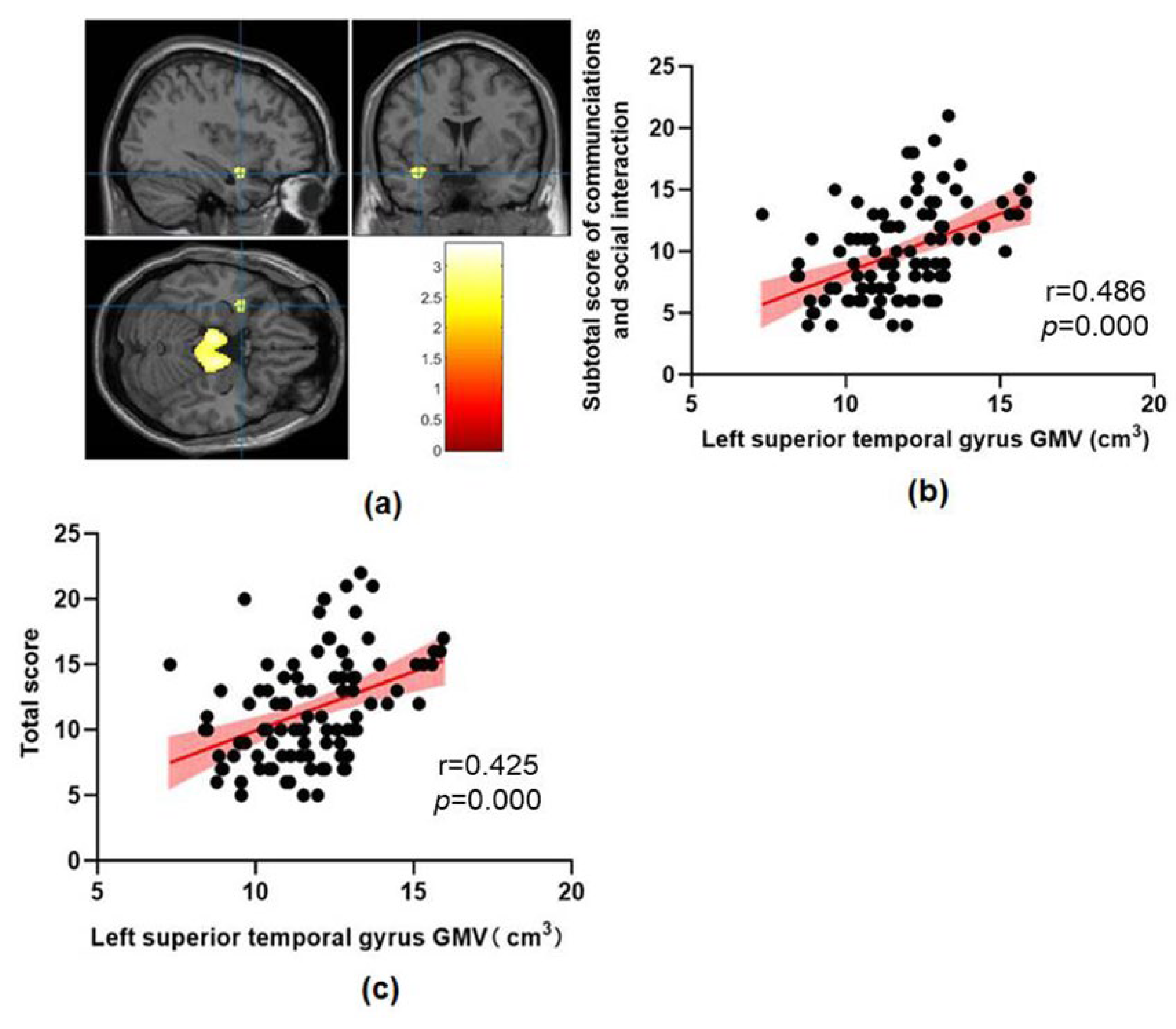 Brain sciences free full text abnormal brain structure is