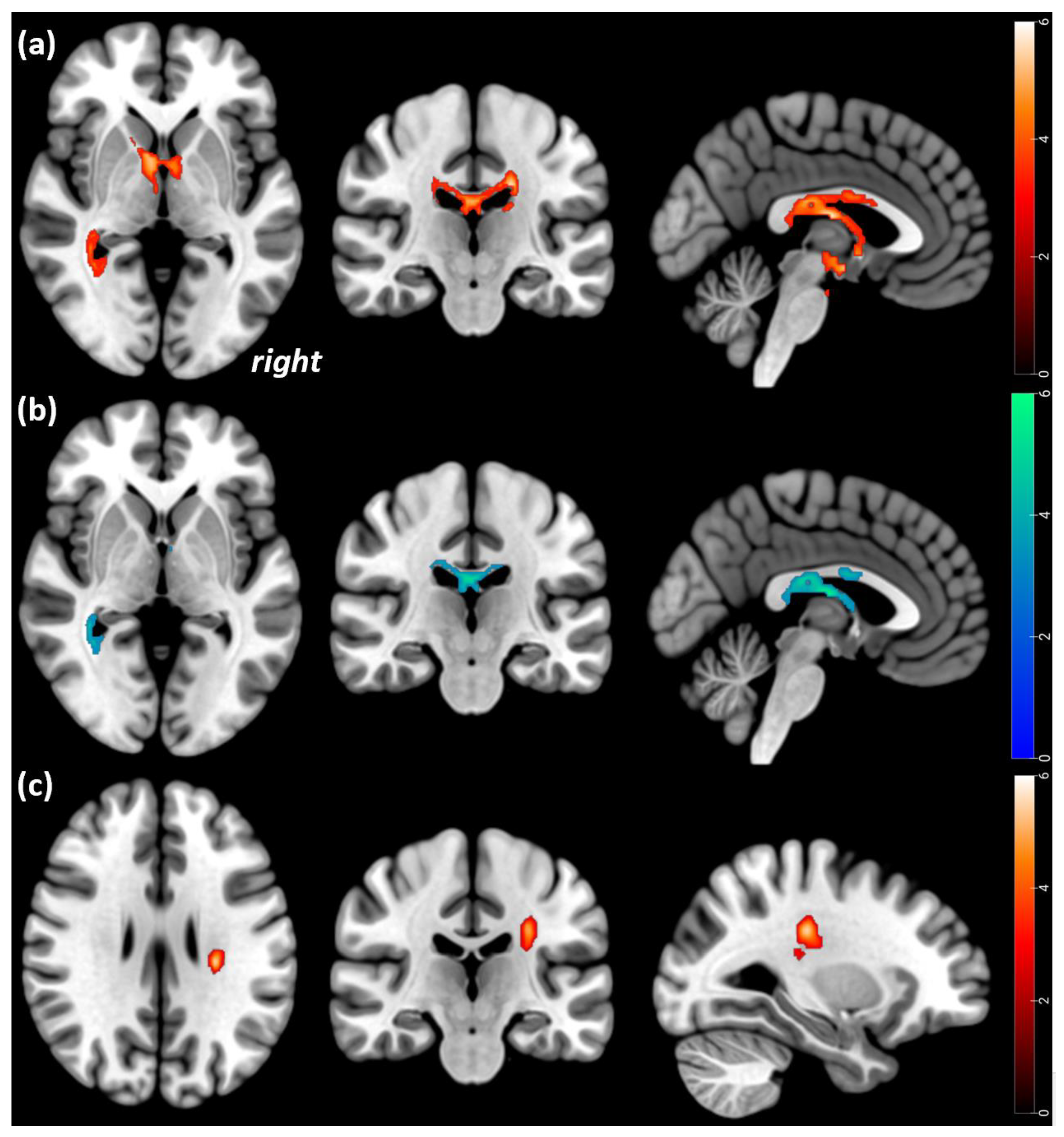 Brainsci 13 00798 g001 Brainsci 13 00798 g001