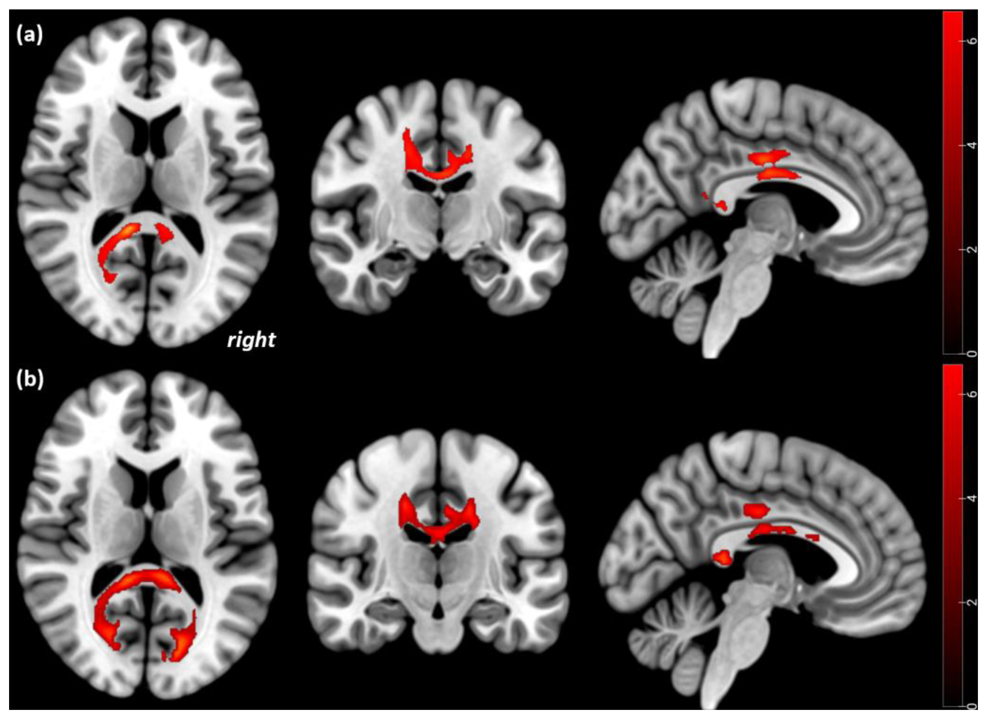 Brainsci 13 00798 g002 Brainsci 13 00798 g002