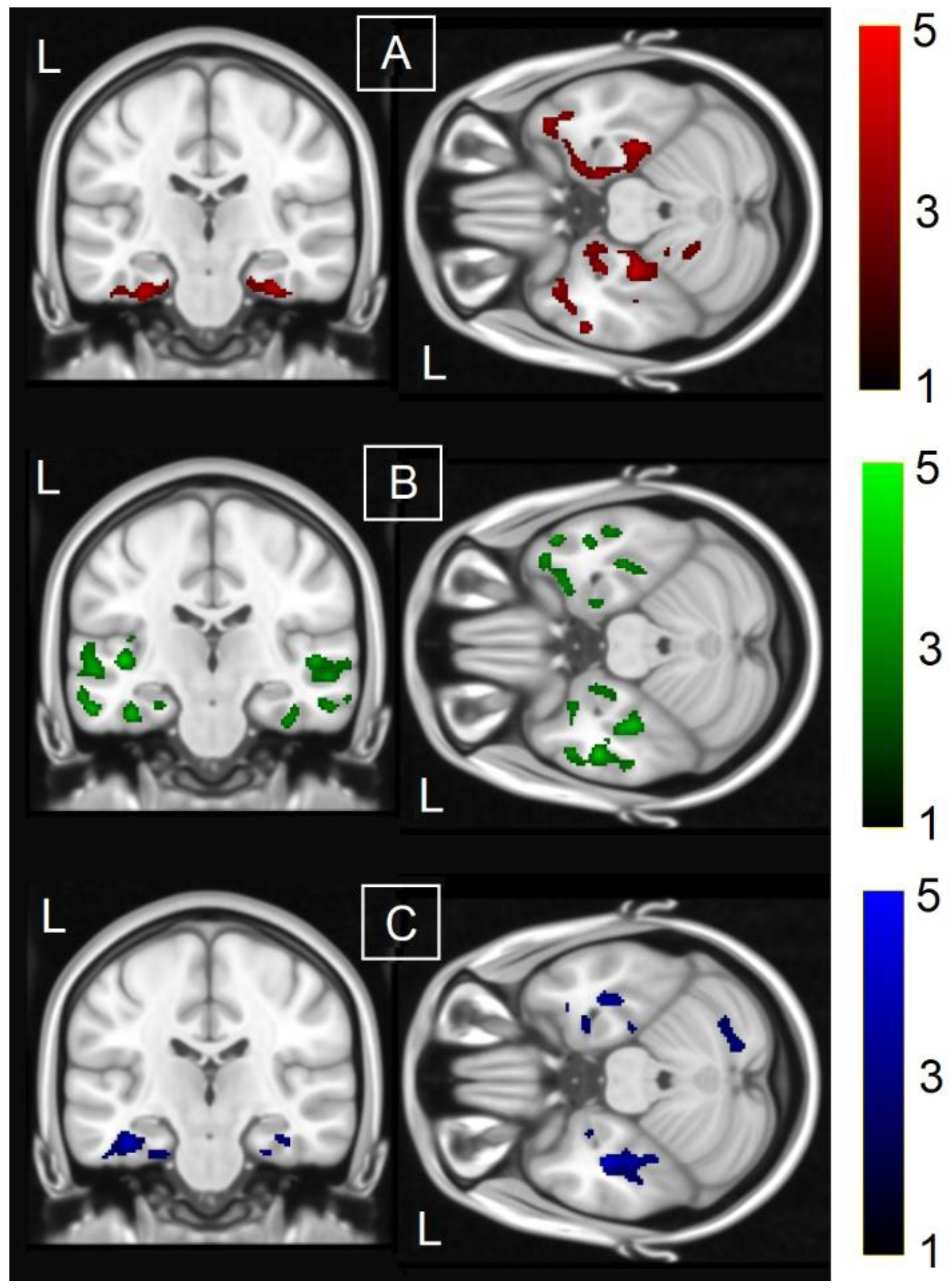 Brainsci 13 00806 g001 Brainsci 13 00806 g001