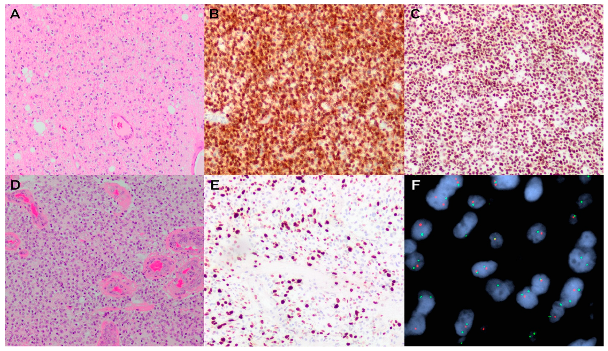 Brainsci 13 00817 g003 Brainsci 13 00817 g003