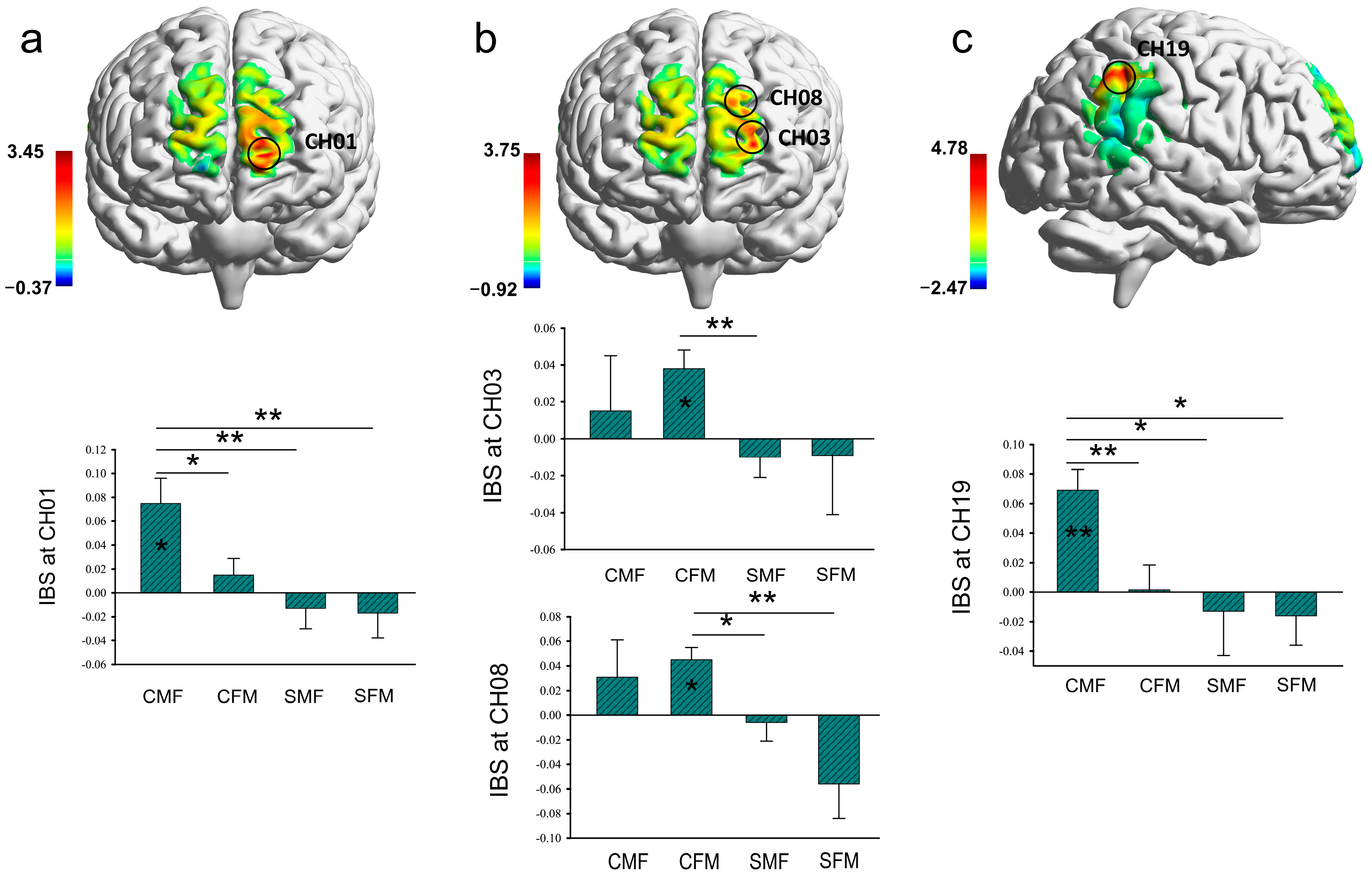 Brainsci 13 00833 g004 Brainsci 13 00833 g004