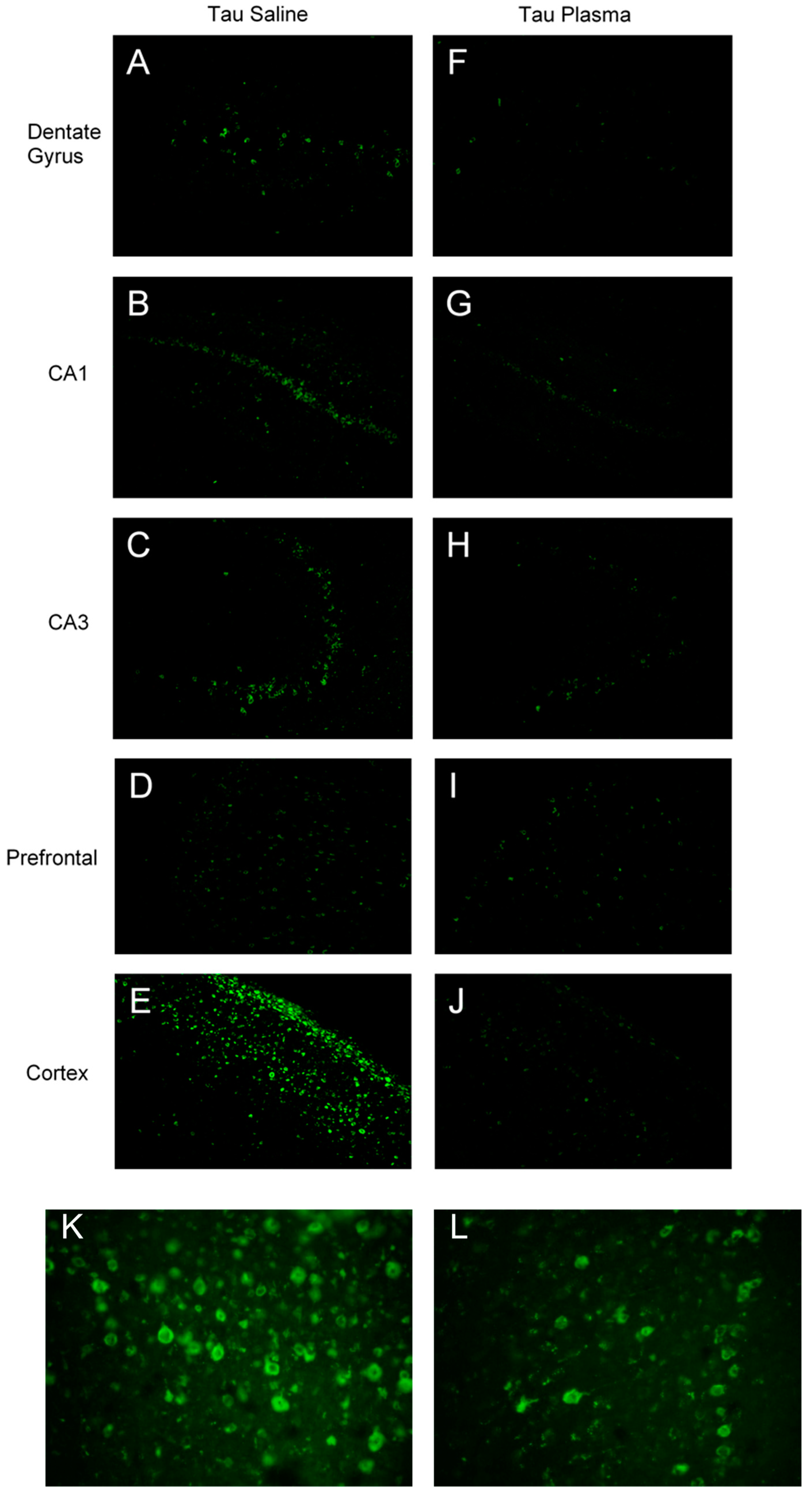 Brainsci 13 00841 g003