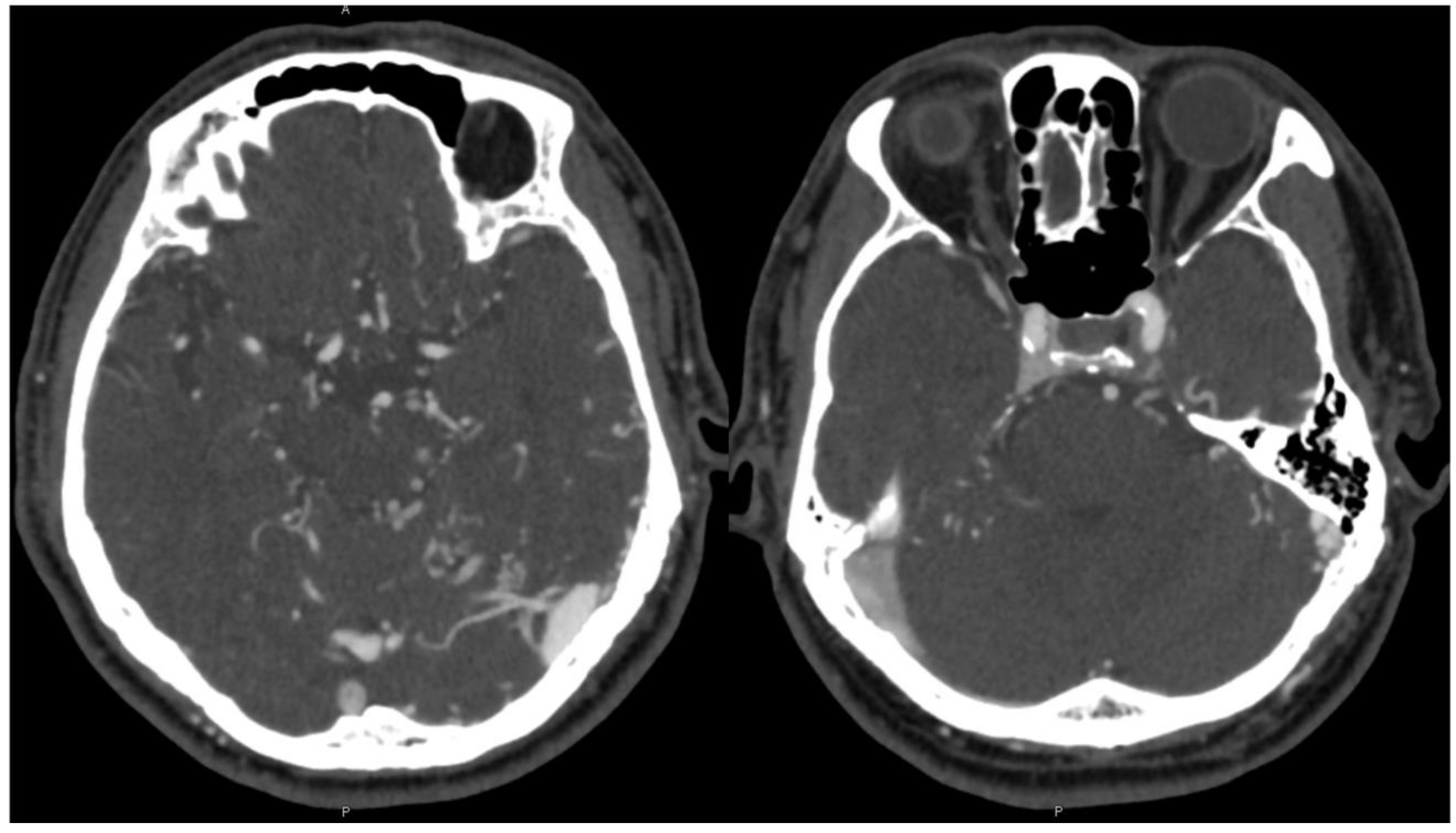 Brainsci 13 00871 g001
