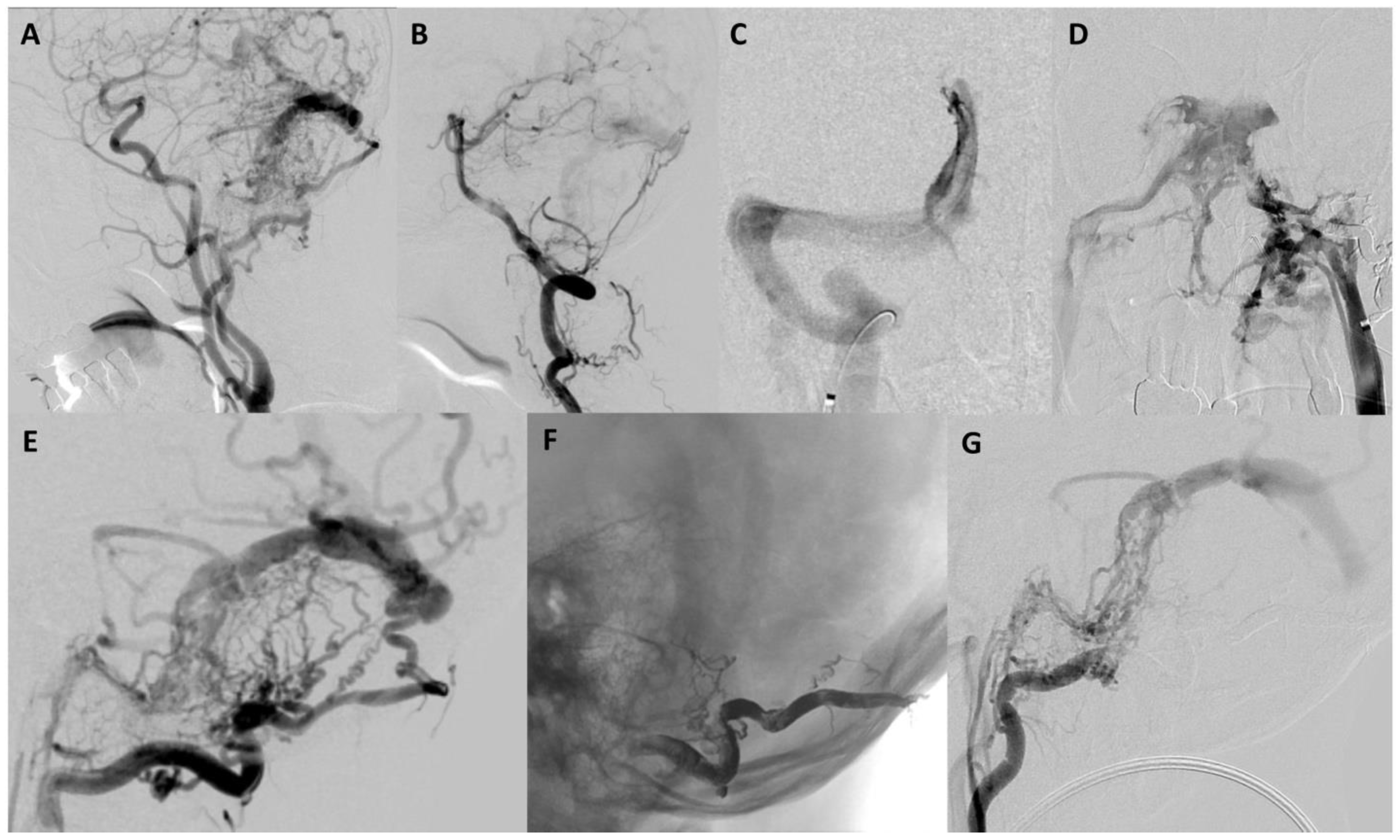 Brainsci 13 00871 g002