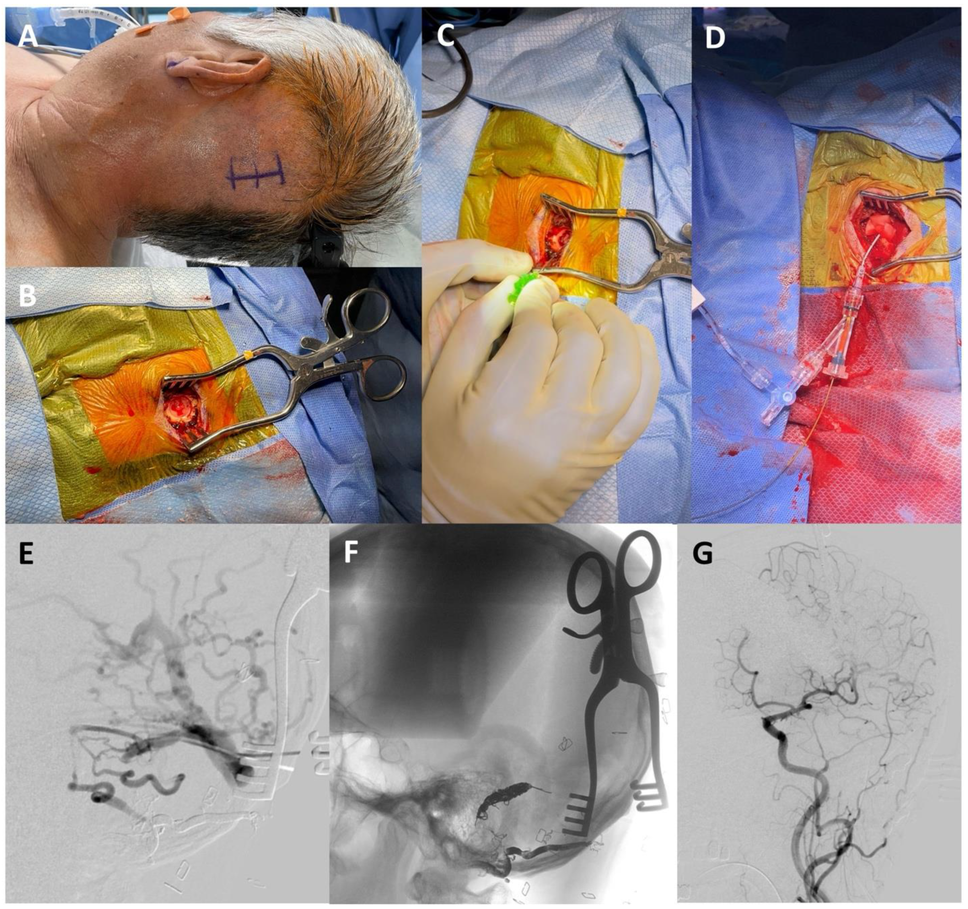 Brainsci 13 00871 g003