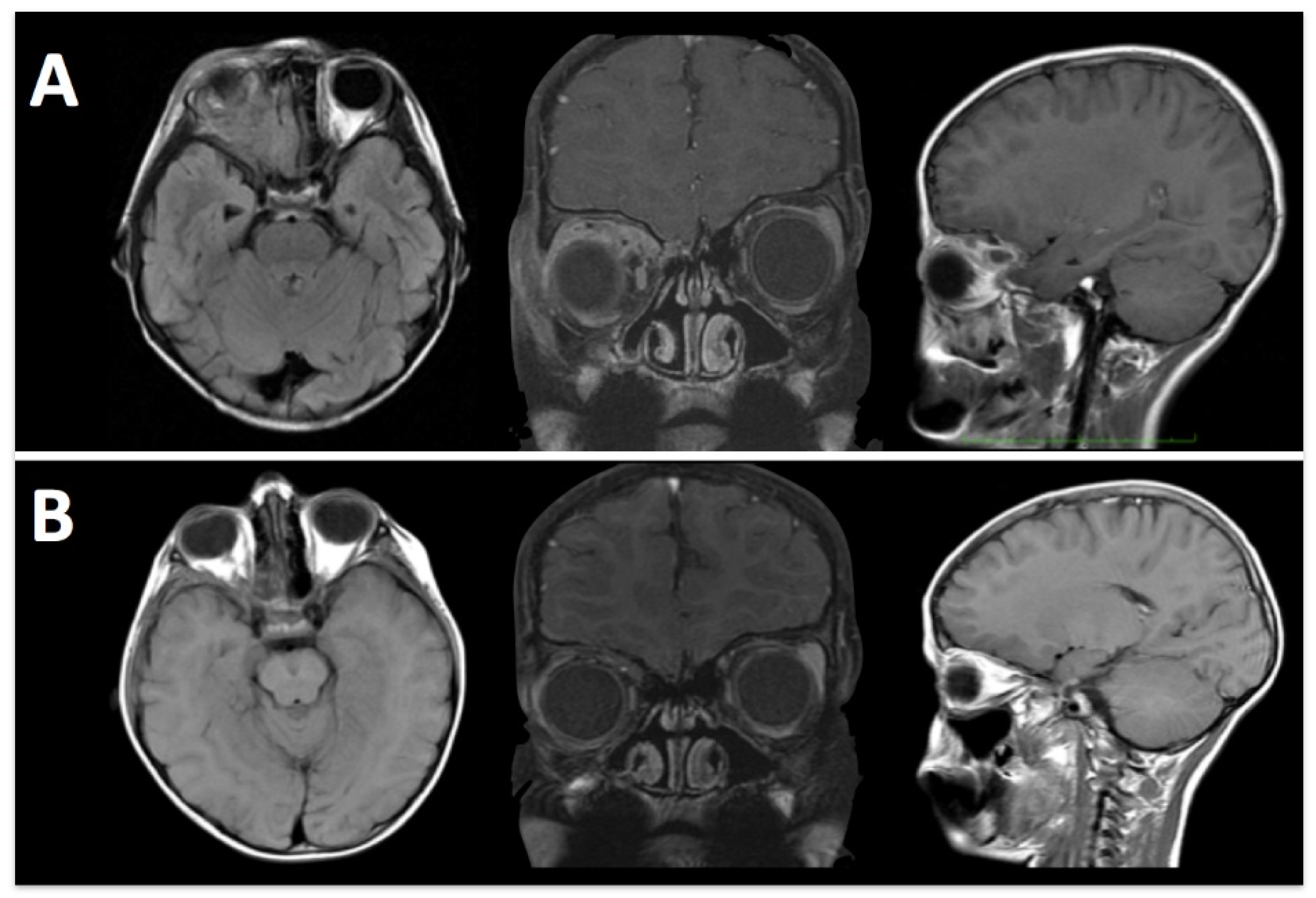 Brainsci 13 00888 g002