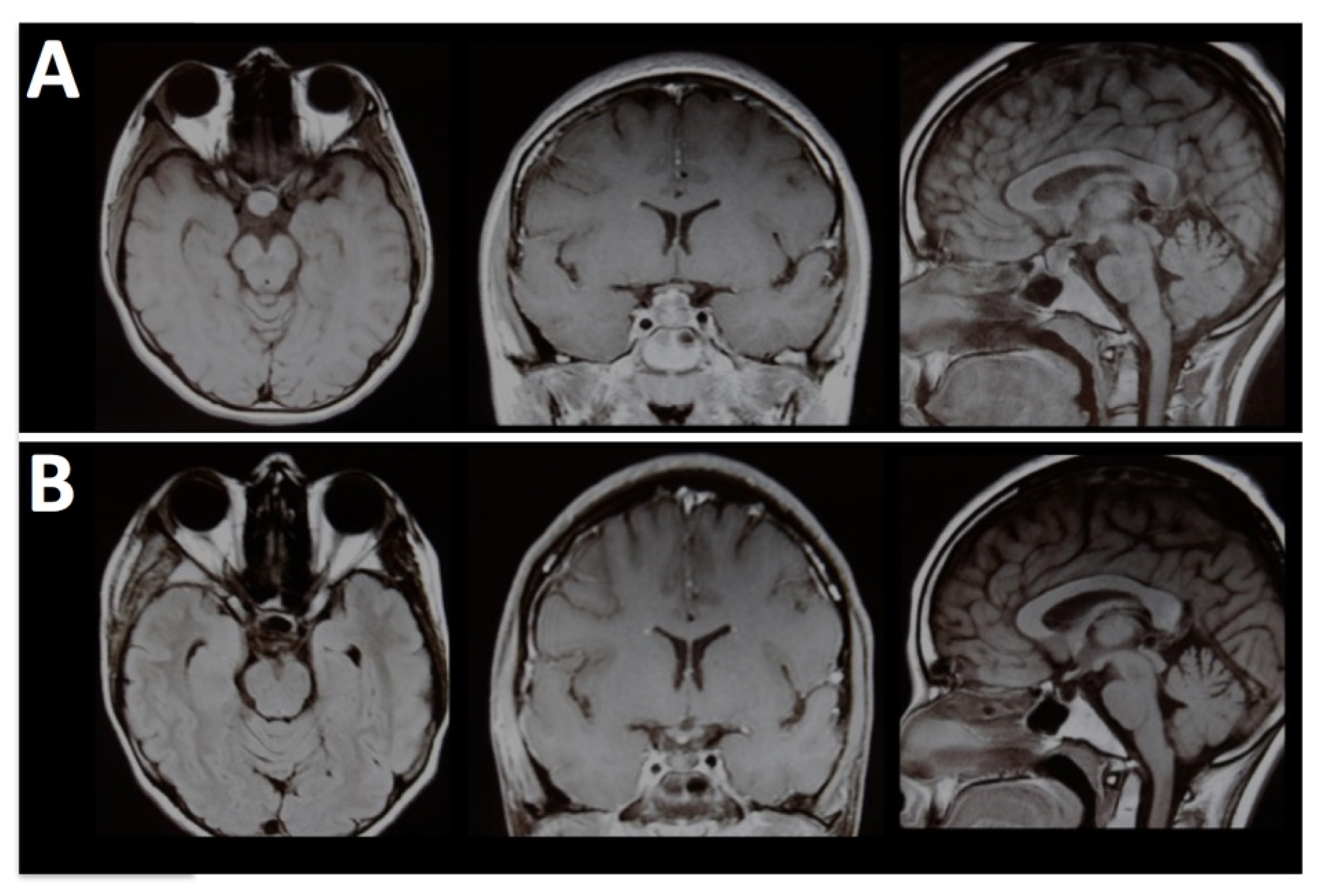 Brainsci 13 00888 g004