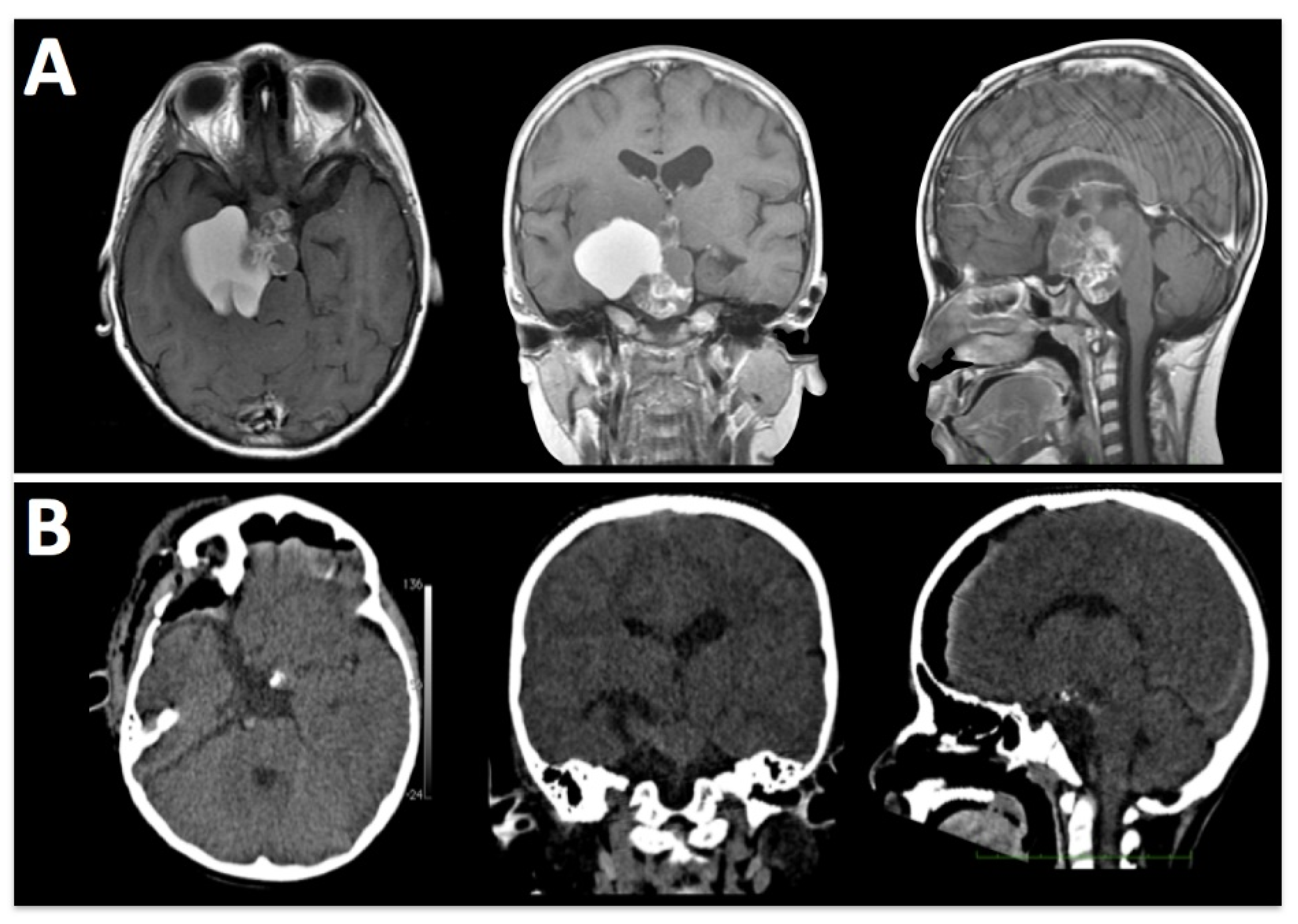 Brainsci 13 00888 g005