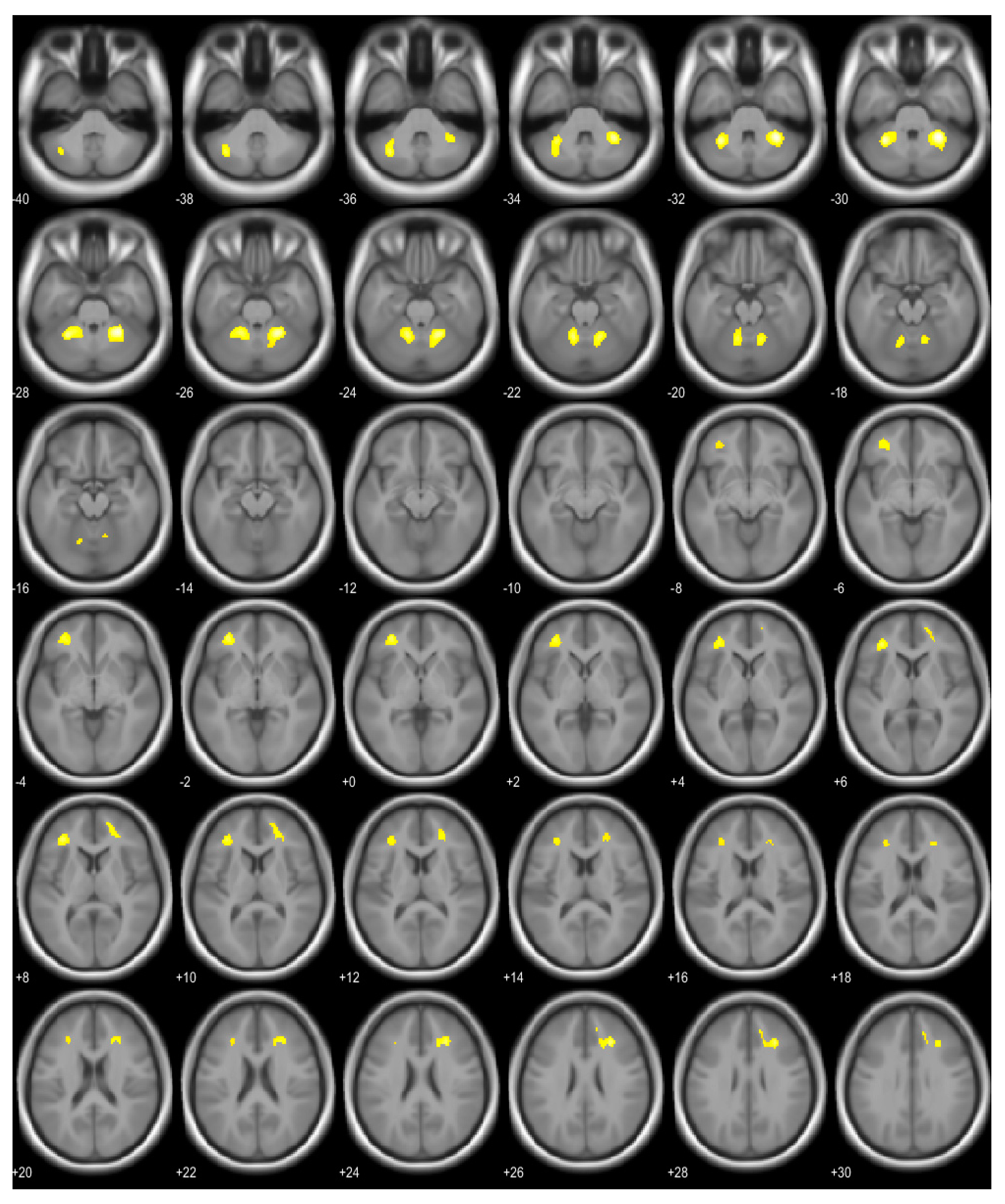 Brainsci 13 00889 g001 Brainsci 13 00889 g001
