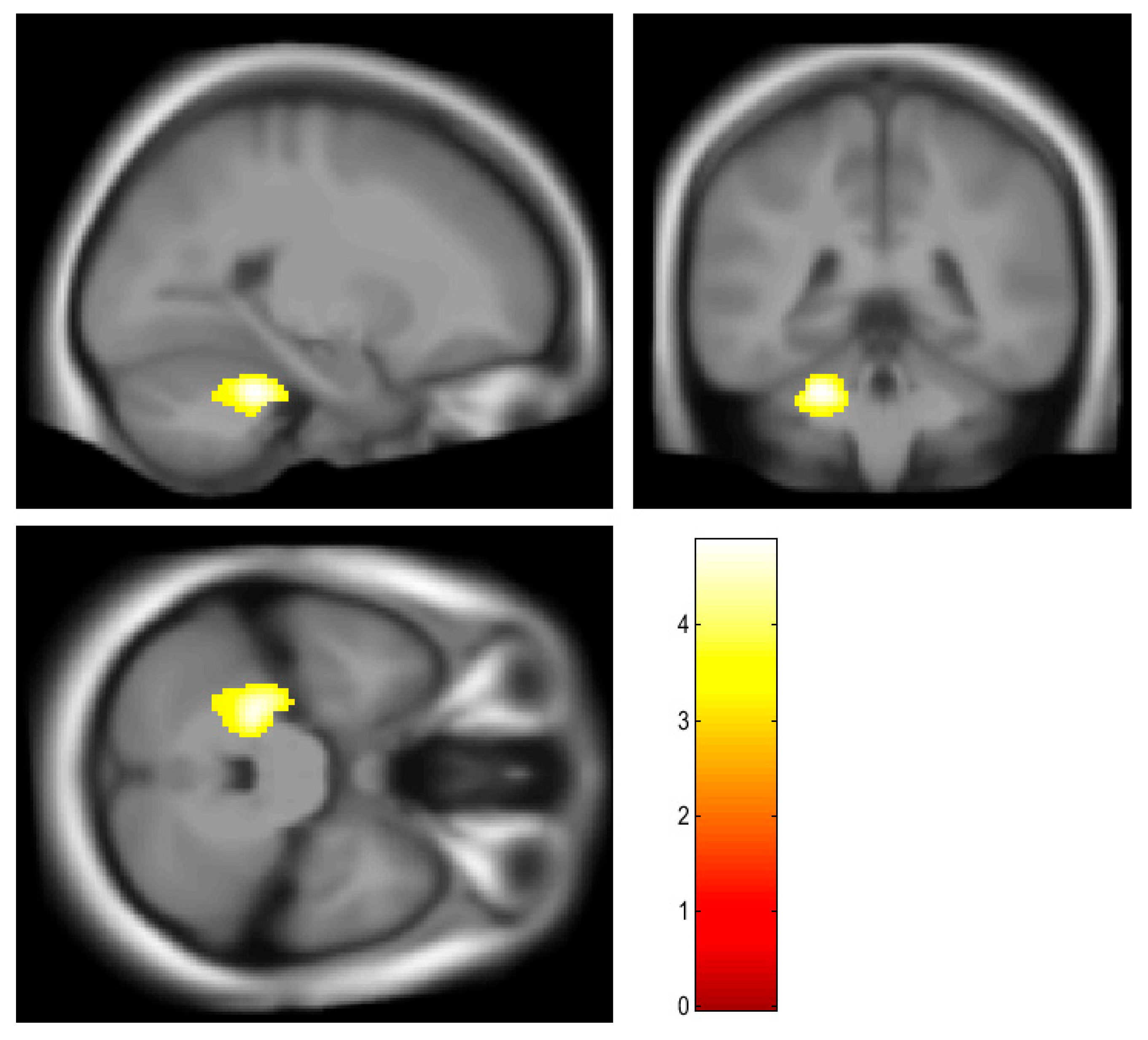 Brainsci 13 00889 g002 Brainsci 13 00889 g002