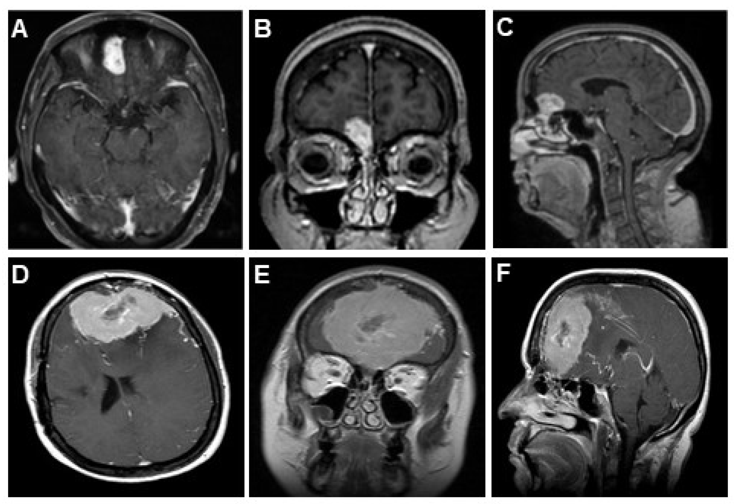 Brainsci 13 00896 g003 Brainsci 13 00896 g003