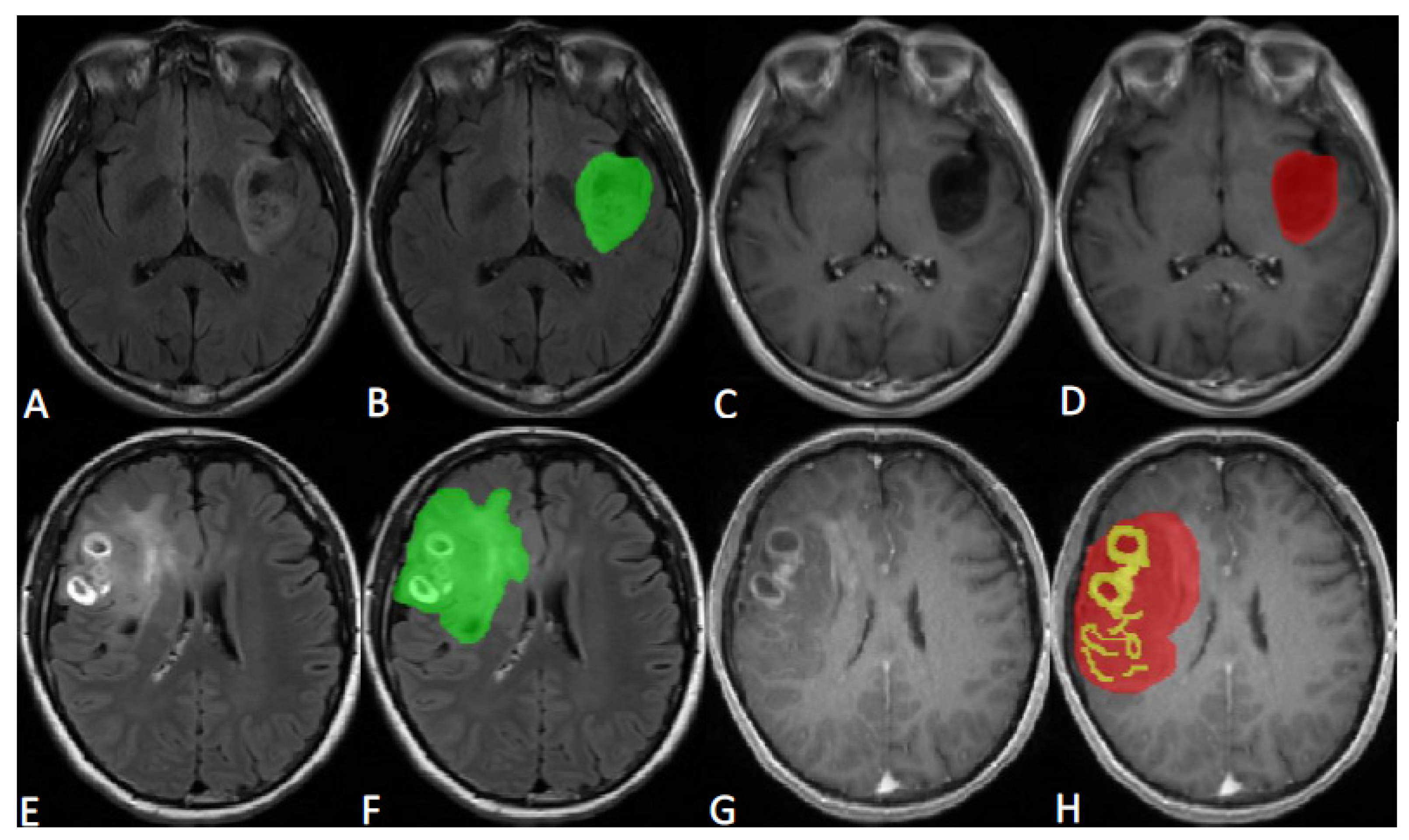 Brainsci 13 00912 g001