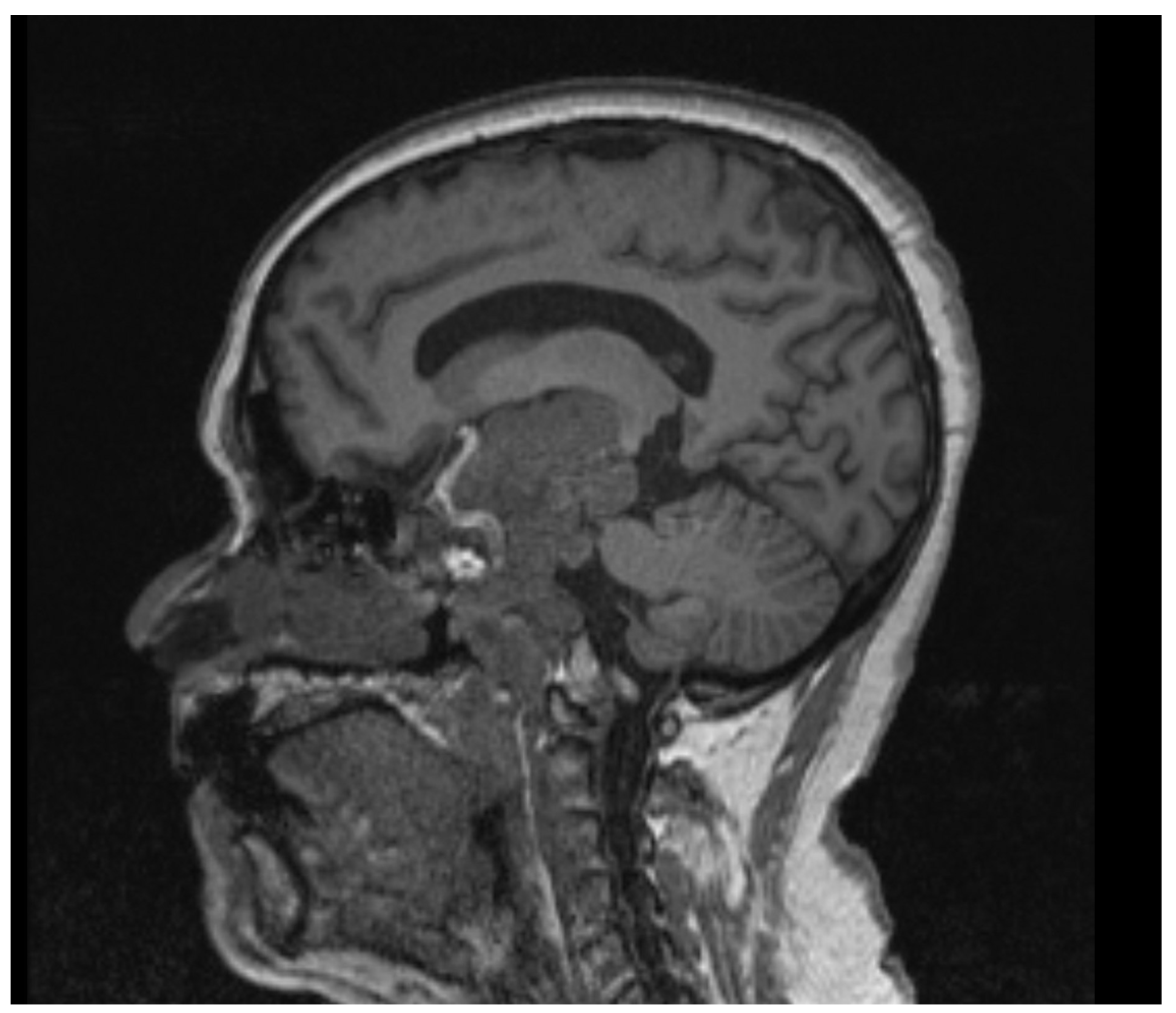 Brainsci 13 00916 g002 Brainsci 13 00916 g002