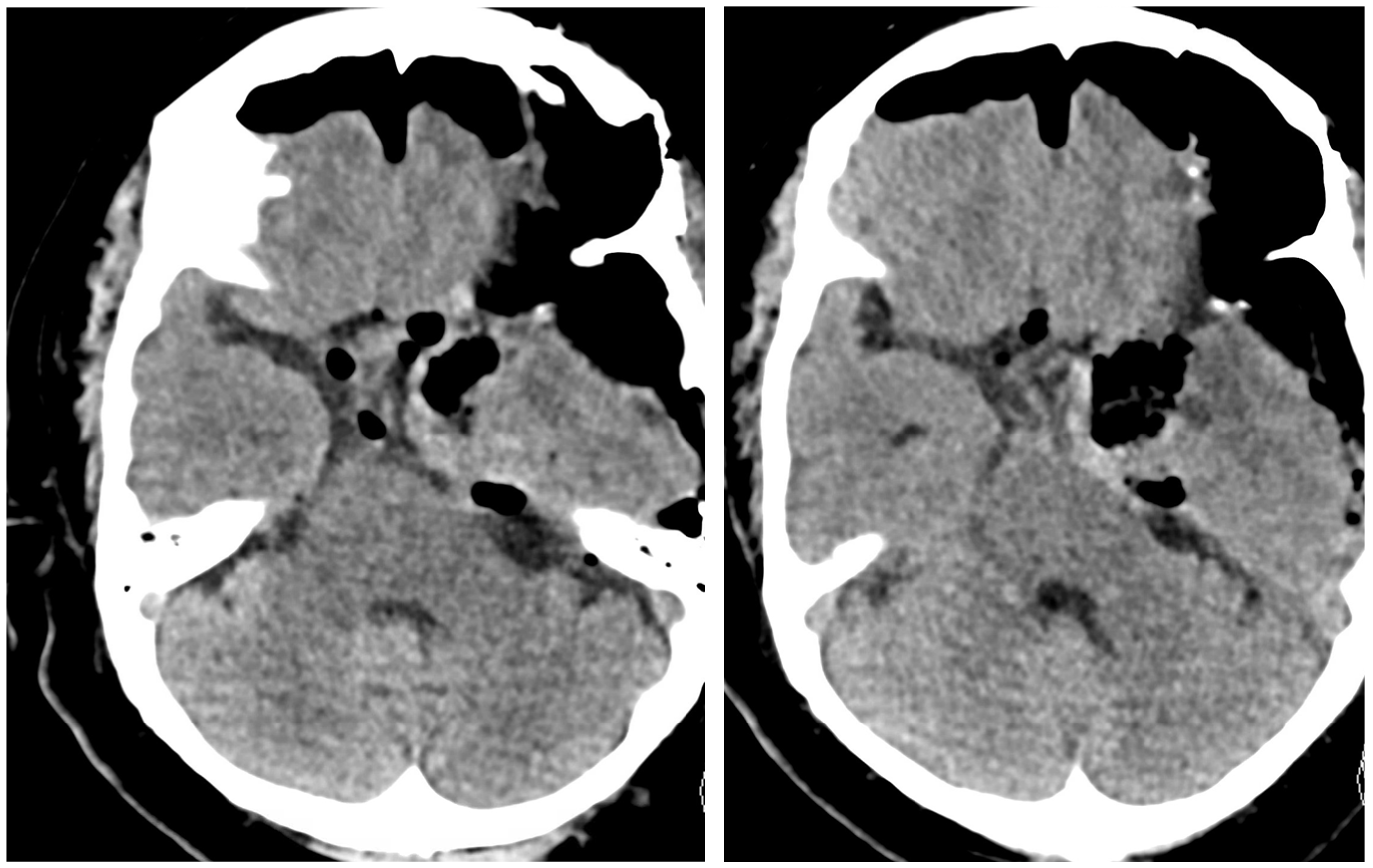 Brainsci 13 00916 g004 Brainsci 13 00916 g004