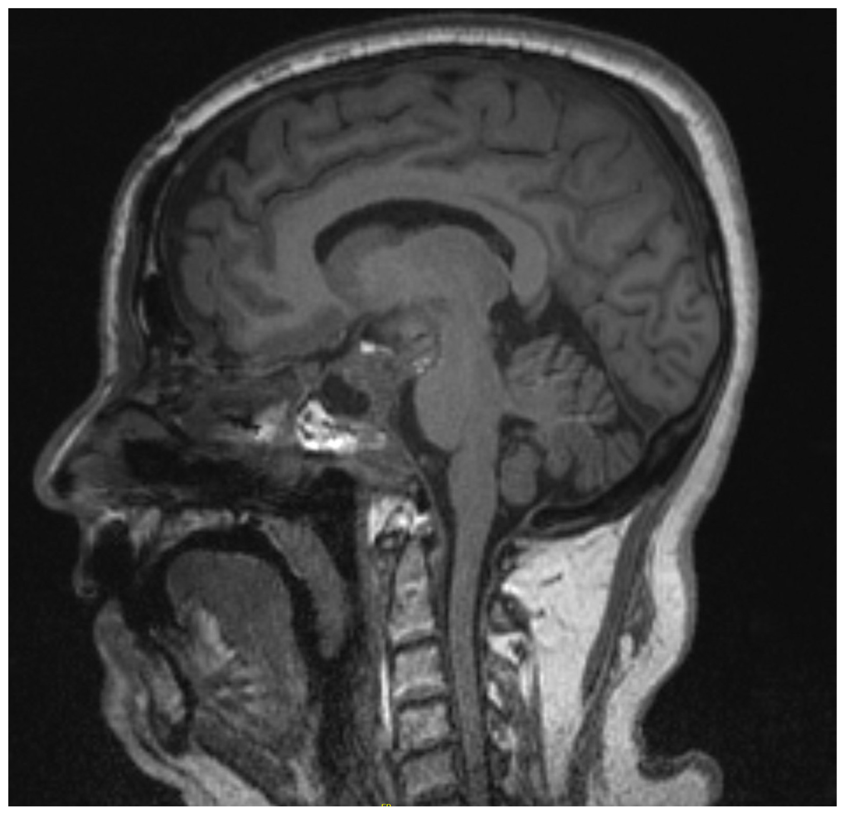 Brainsci 13 00916 g005 Brainsci 13 00916 g005