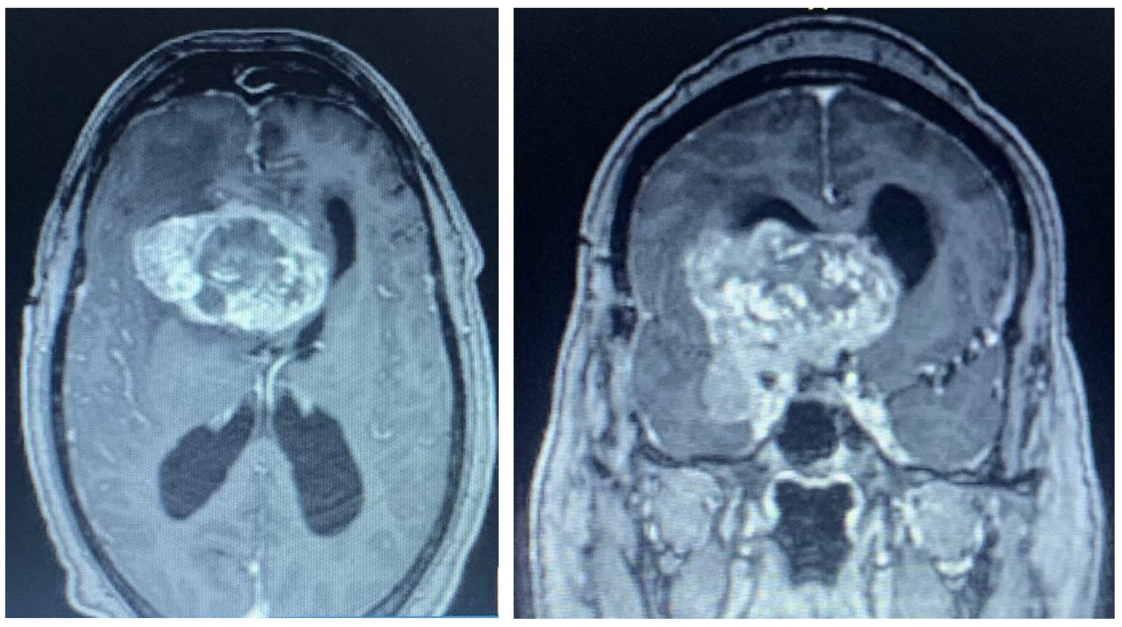 Brainsci 13 00916 g007 Brainsci 13 00916 g007