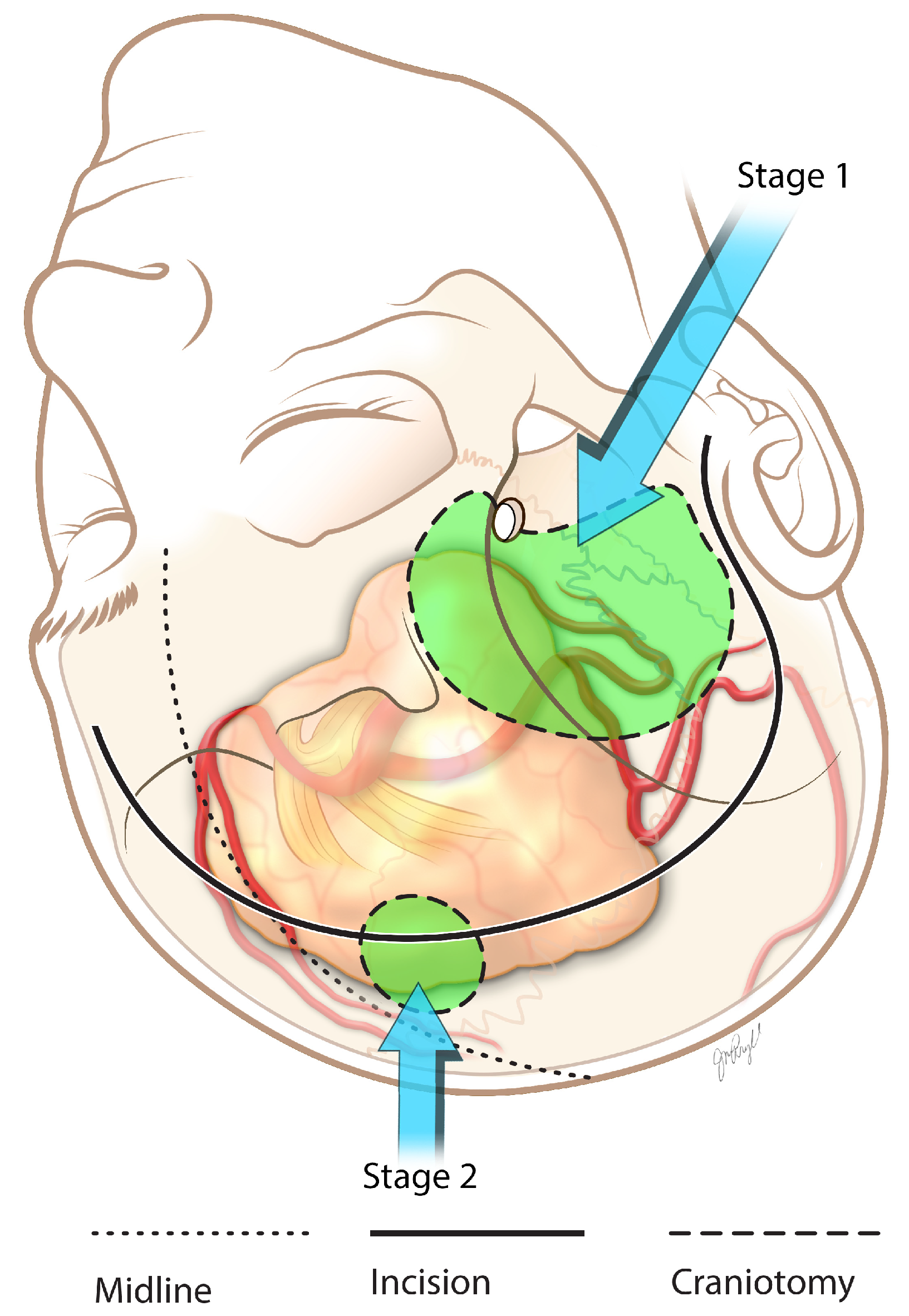 Brainsci 13 00916 g009 Brainsci 13 00916 g009